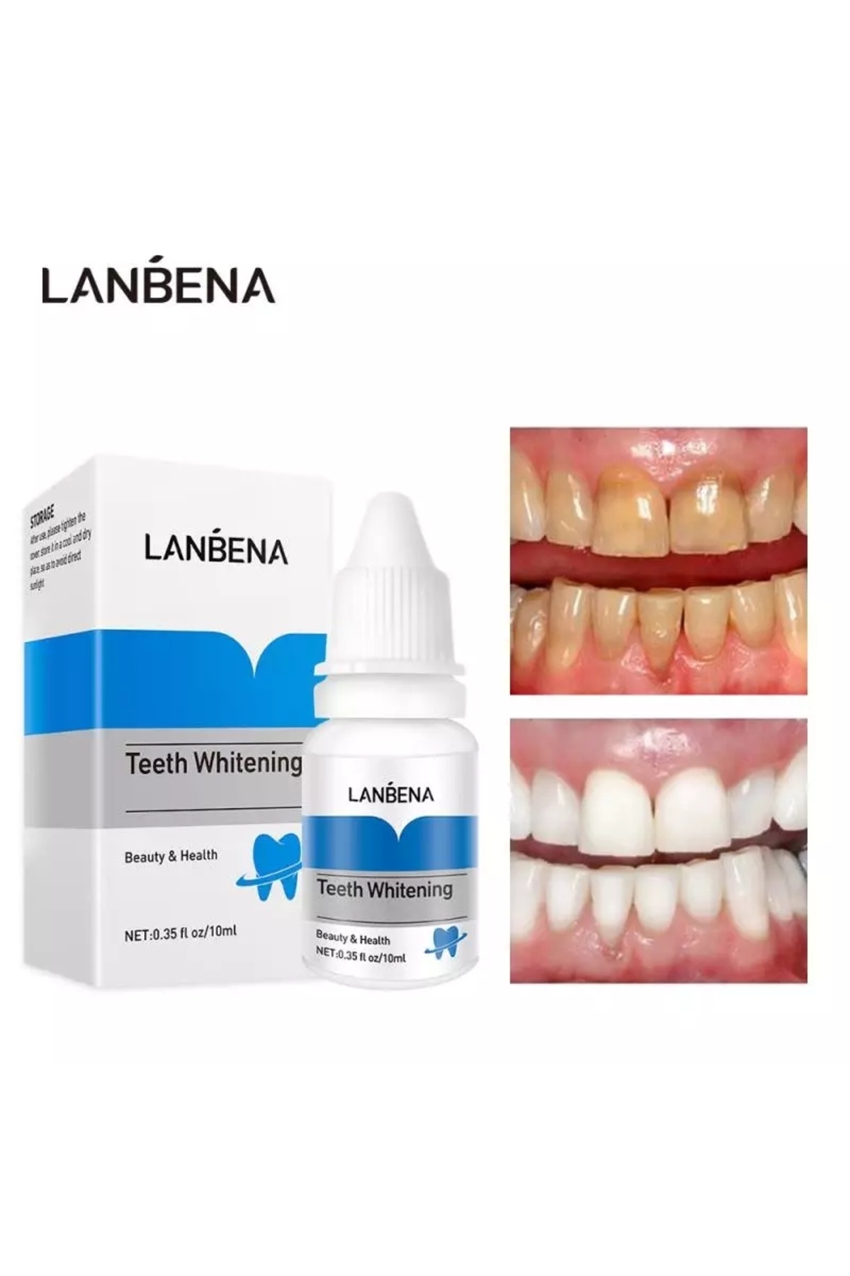 Lanbent Lanbena ® Diş Plağı Temizleme Diş Taşı Temizliği Diş Sararması Beyazlatma Beyazlatıcı