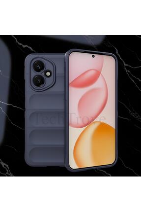 TechTrove Honor 400 Kılıf Esnek Oyuklu Arka Yüzey Tasarımlı Silikon A++ Kalit...