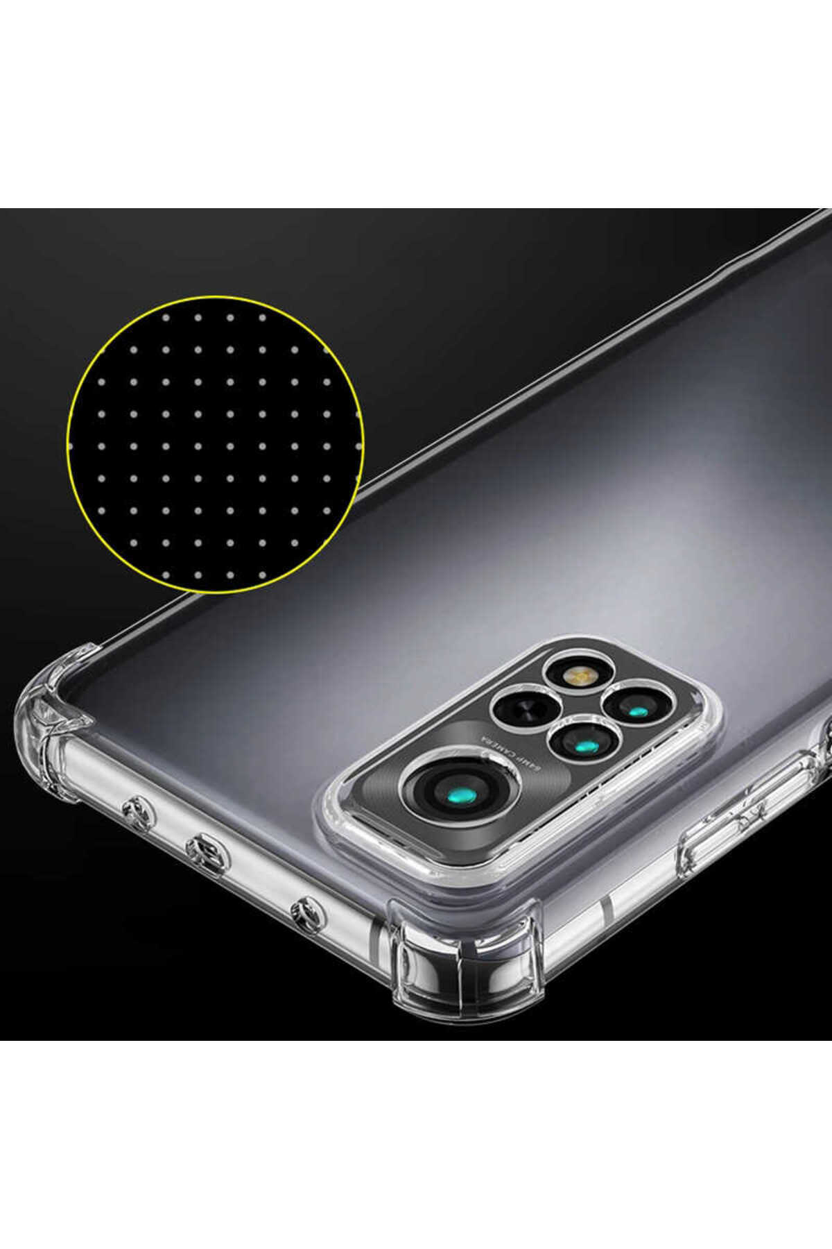 VELMORA-Redmi Note 11 Pro 5g Case Vlmr Camera Protected Nitro Anti Shock Silicone - Colorless 3