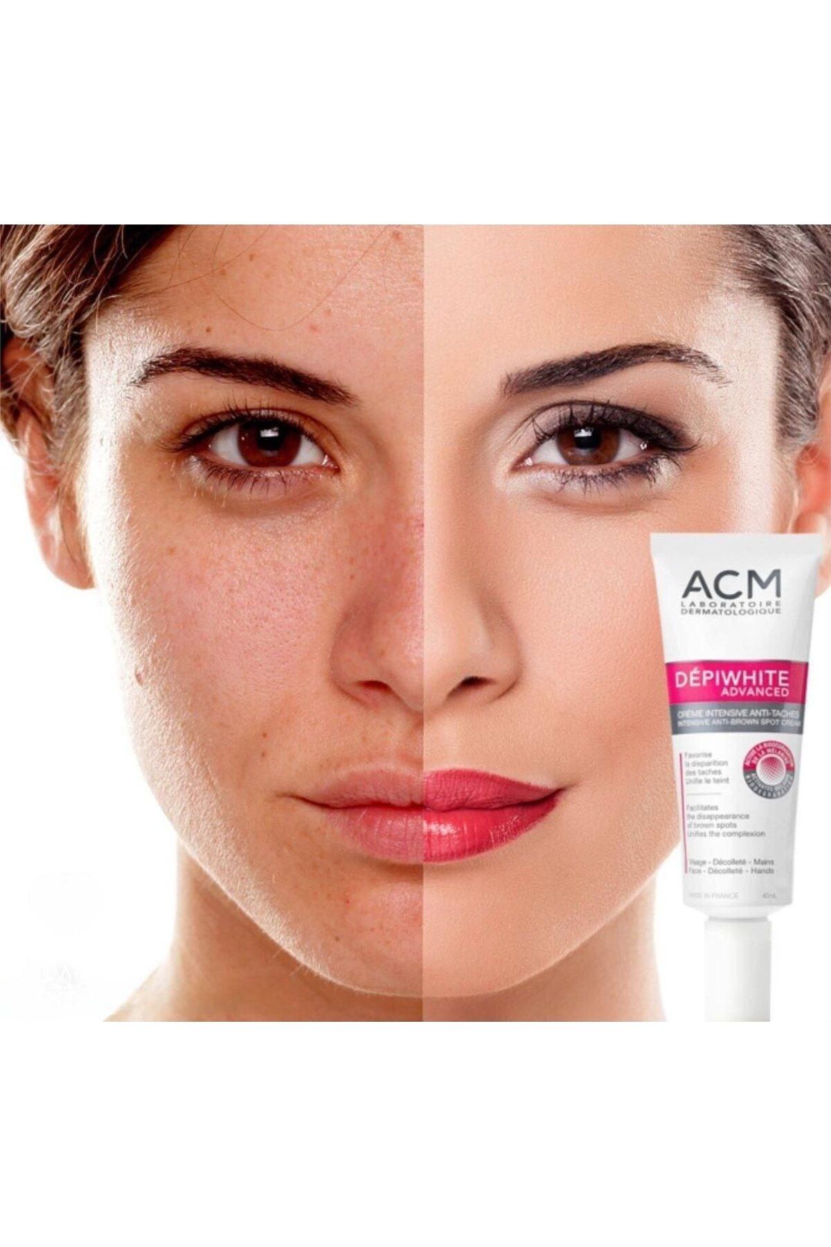 ACM-Depiwhite Advanced Anti-Blemish Cream Skin Whitening Effective Against Blemishes Orginal 40 ml 2025 2
