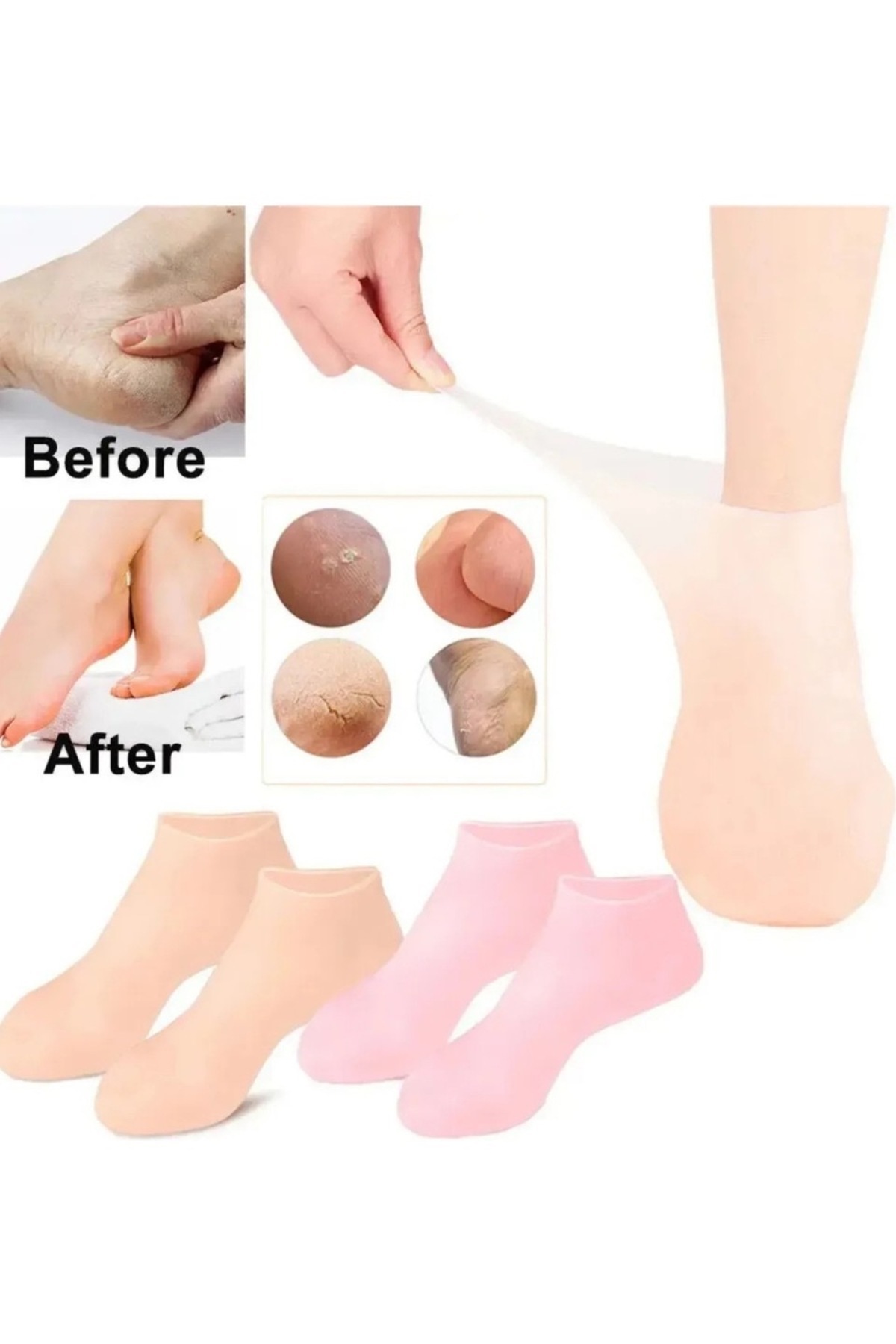 Home Silikon Ayak Bakım Çorabı Nemlendirici Jel Çorap Çatlak Önleyici Ölü Deri Atıcı Çorap Ayak Bakımı