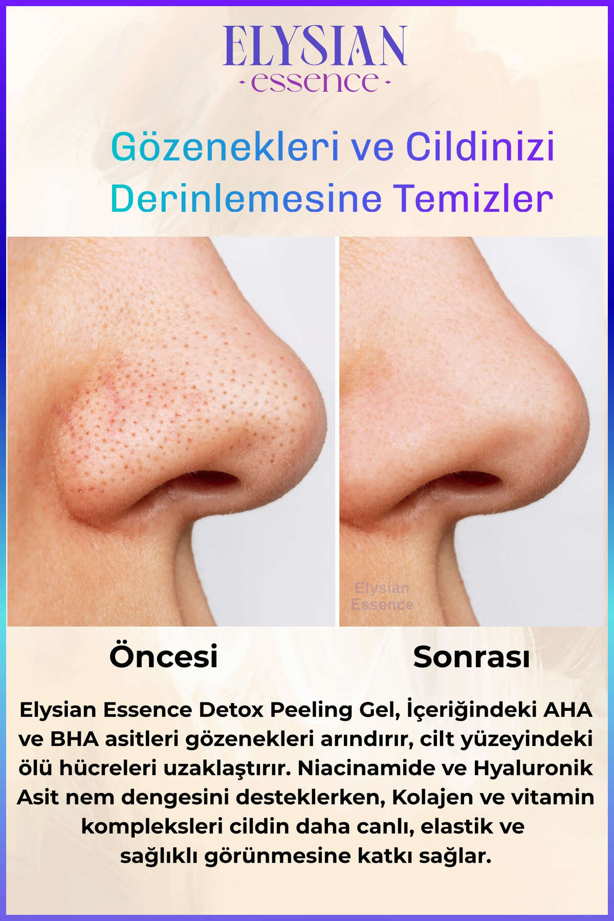 Detox Peeling Jel 2'li Set | Ölü Hücre Arındırıcı Temizleme Jeli | Yüz ve Vücut Temizleyici AHA BHA — 4440.2 — تصویر 3 از 7