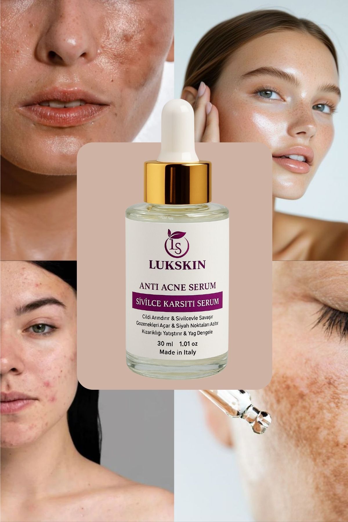 Akne ve Karşıtı Serum - Akne Kurutucu - Siyah Nokta Leke İz Akne Komedon Karşıtı — 6 — تصویر 3 از 6