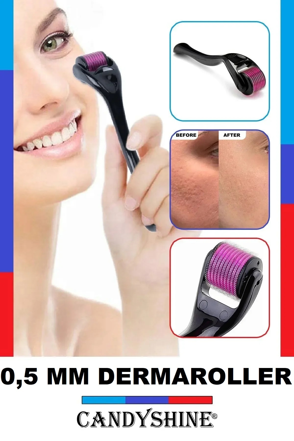 CandyShine 0,5 Mm Deluxe Titanyum 540 Iğneli Cilt Yüz Vücut Saç Yenileyici Dermaroller Cilt Bakım Aleti