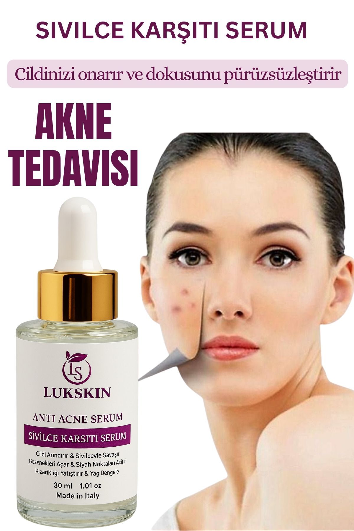 Akne ve Karşıtı Serum - Akne Kurutucu - Siyah Nokta Leke İz Akne Komedon Karşıtı — 6 — تصویر 6 از 6