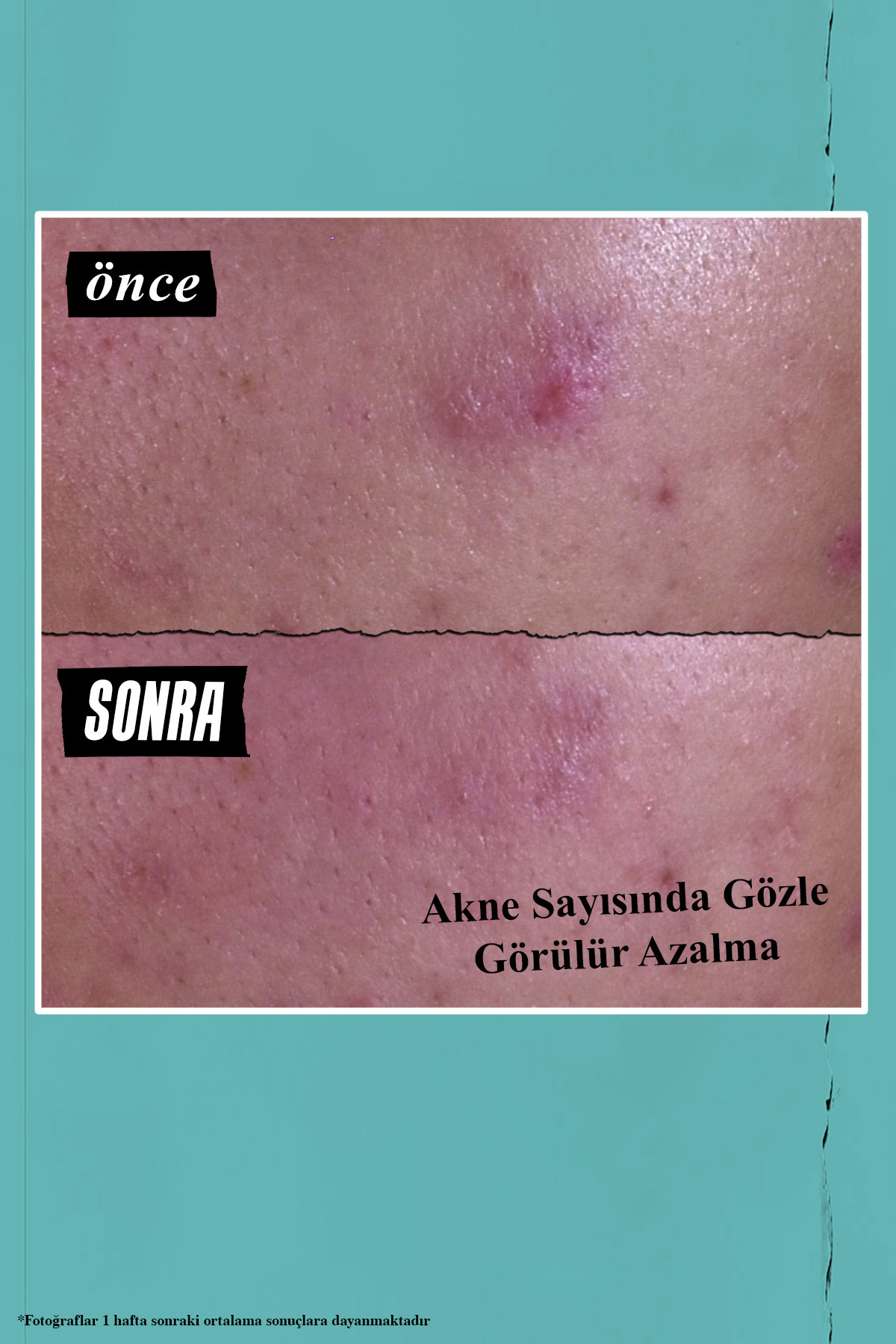 Blemish-Targeting Sivilce Karşıtı 3’ü 1 Arada Maske, Bölgesel Bakım & Temizleyici 125 ml — S5893801 — تصویر 8 از 8