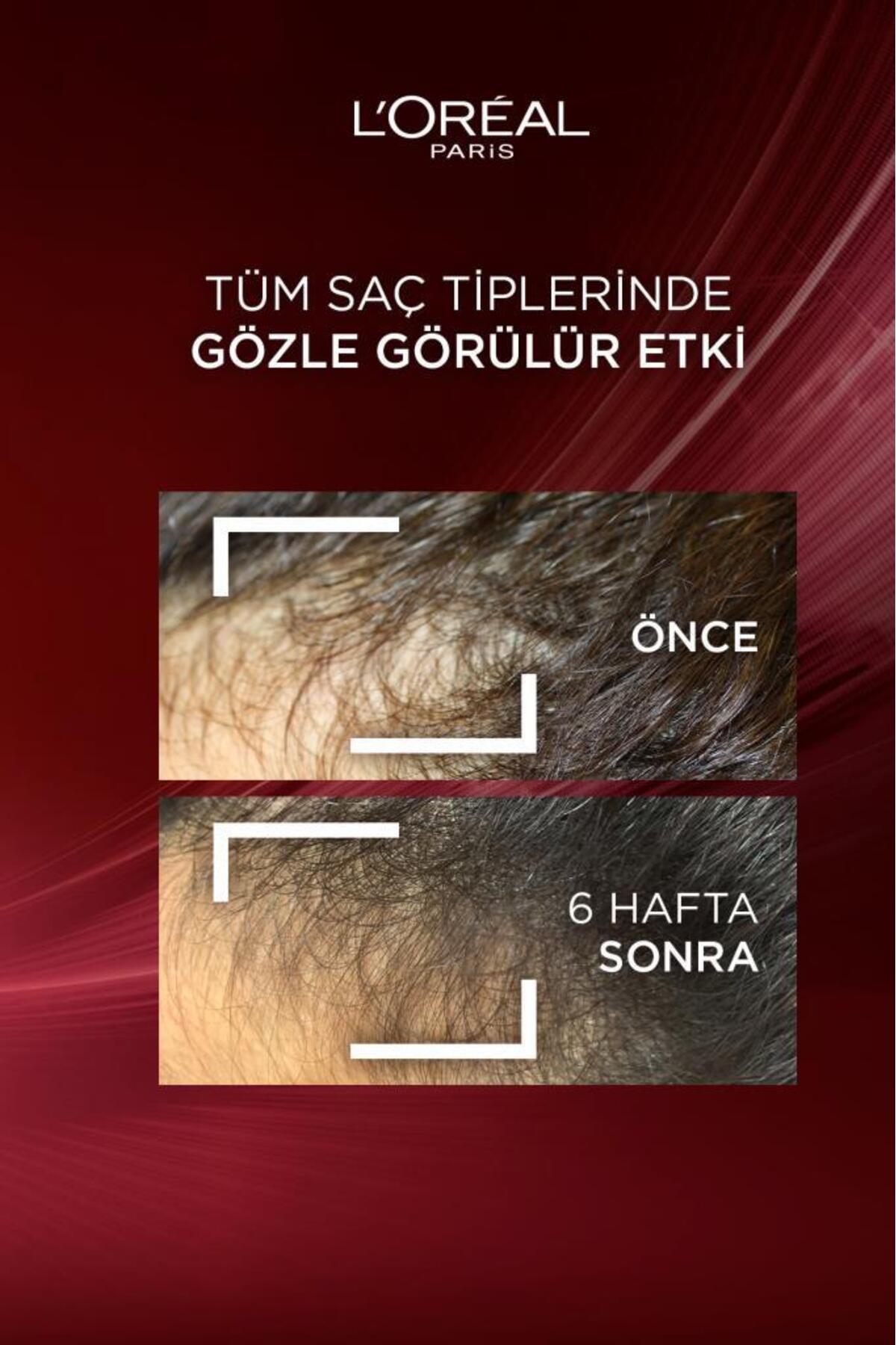 2'li Komple Direnç Dökülme Karşıtı Saç Bakım Kremi 250 ml — PKTELSVKMPLDRNCASHIKI — تصویر 6 از 8