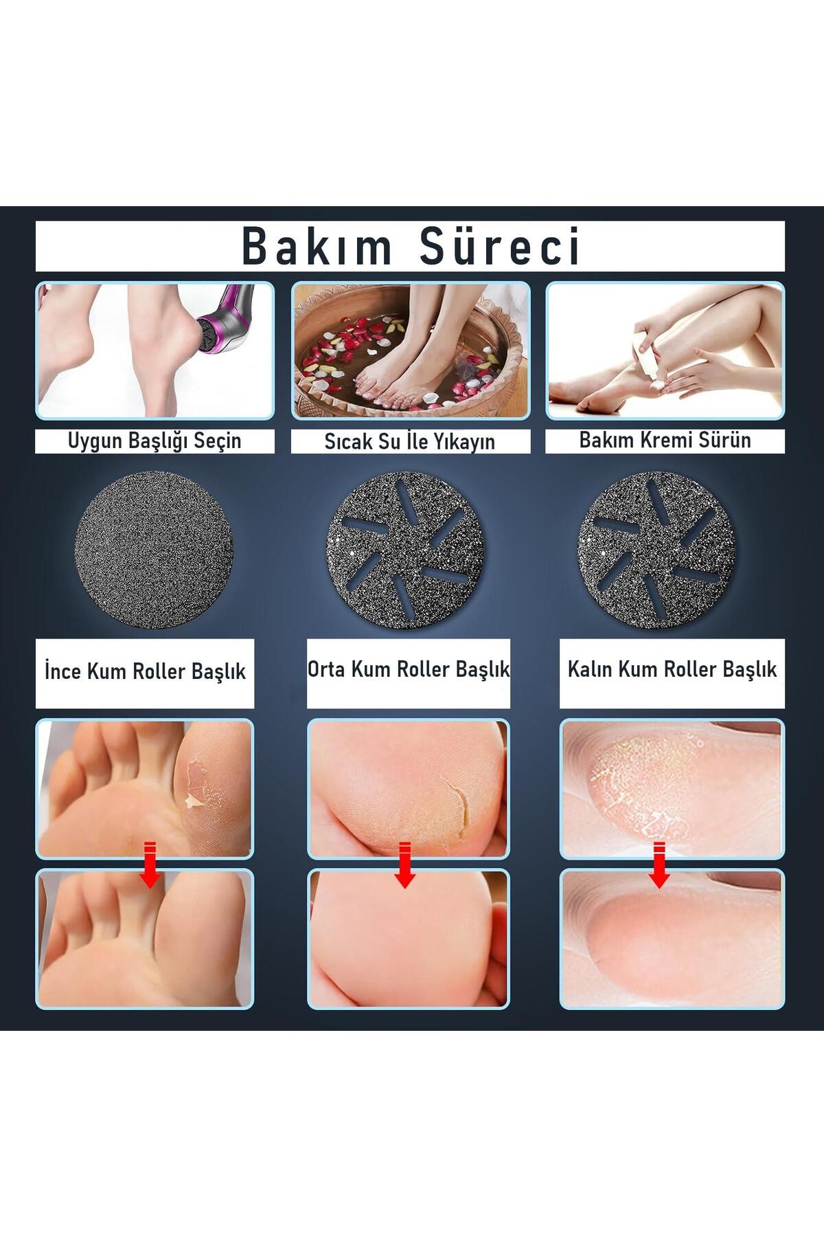 Profesyonel Ayak Bakım Cihazı 360° Dönen Başlık Dijital Ekranlı, Şarjlı & 10 Parça Pedikür Kiti Mor — MT-510 Foot Care Machine Mor — تصویر 6 از 9