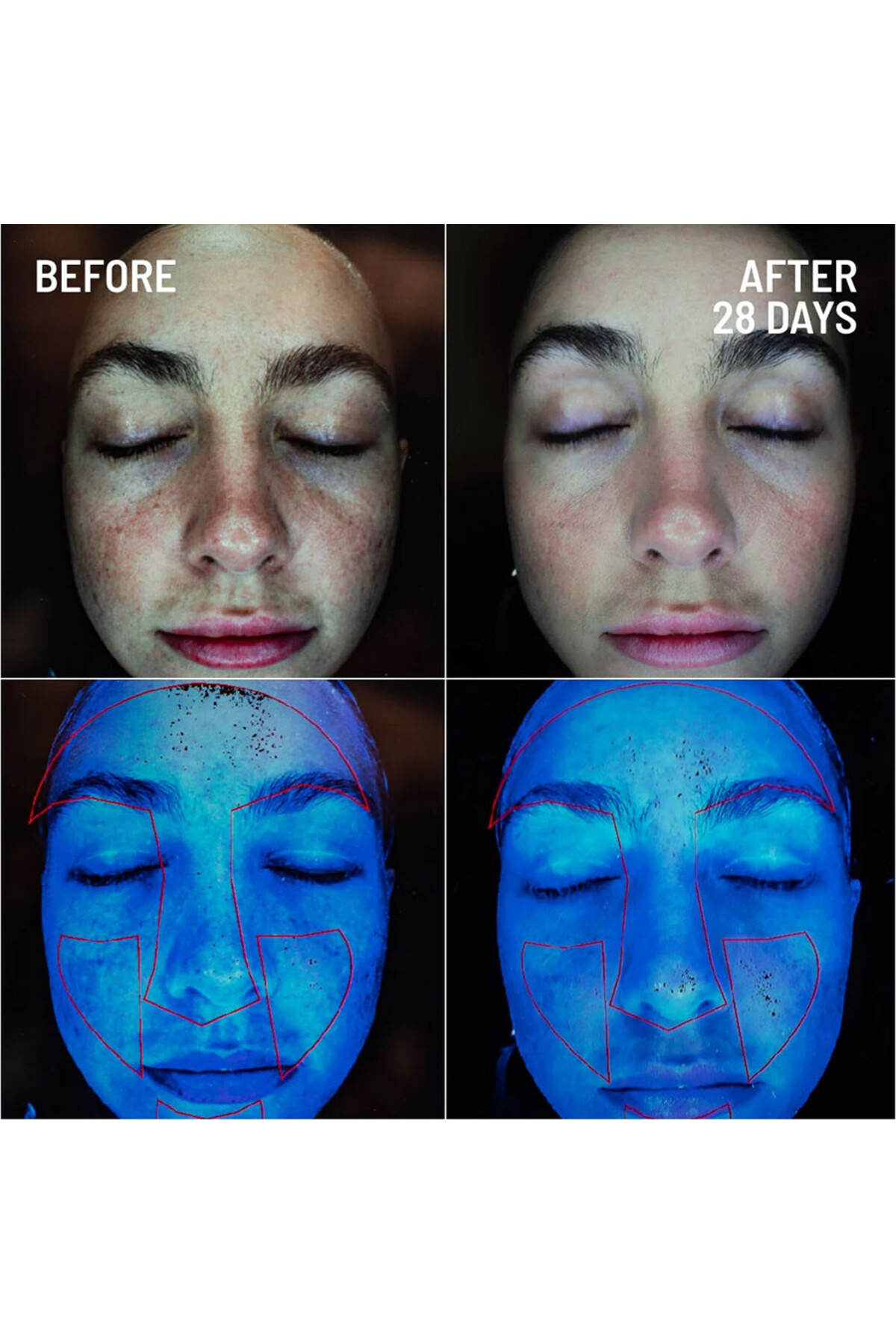 Microdermabrasion Exfoliating Face Cream 60 g – Cildi Yenileyici Peeling Kremi — DRB-MEF-60 — تصویر 3 از 4