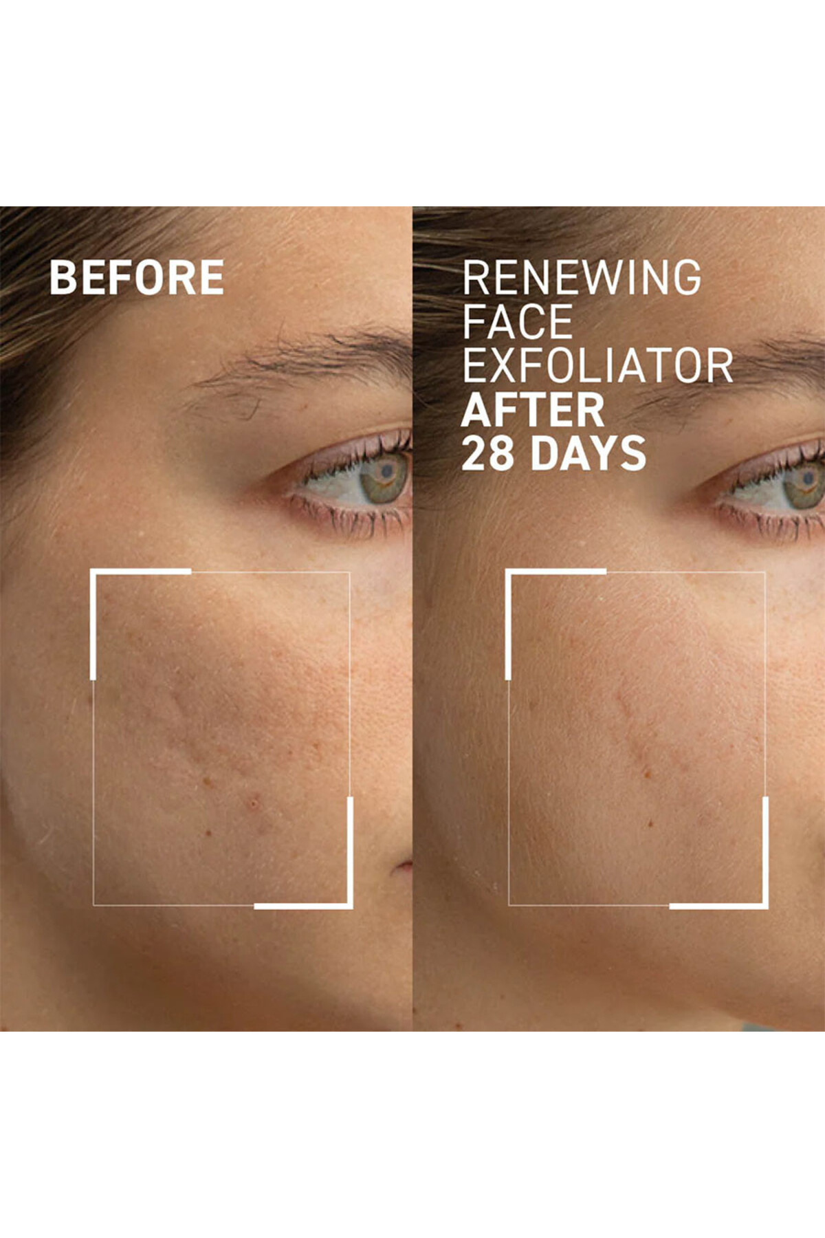 Microdermabrasion Exfoliating Face Cream 60 g – Cildi Yenileyici Peeling Kremi — DRB-MEF-60 — تصویر 4 از 4