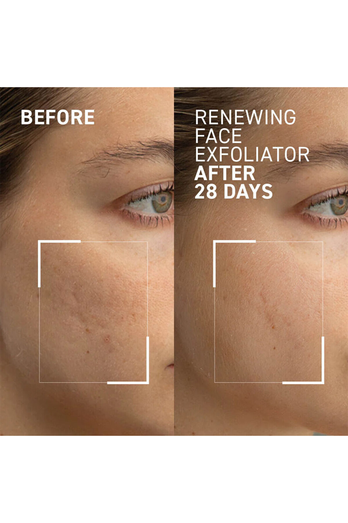 İnce Çizgileri Giderici ve İnce Kırışıklık Karşıtı Canlandırıcı Yenileyici Peeling Yüz Kremi — 5GD6FG46D4G77 — تصویر 4 از 4