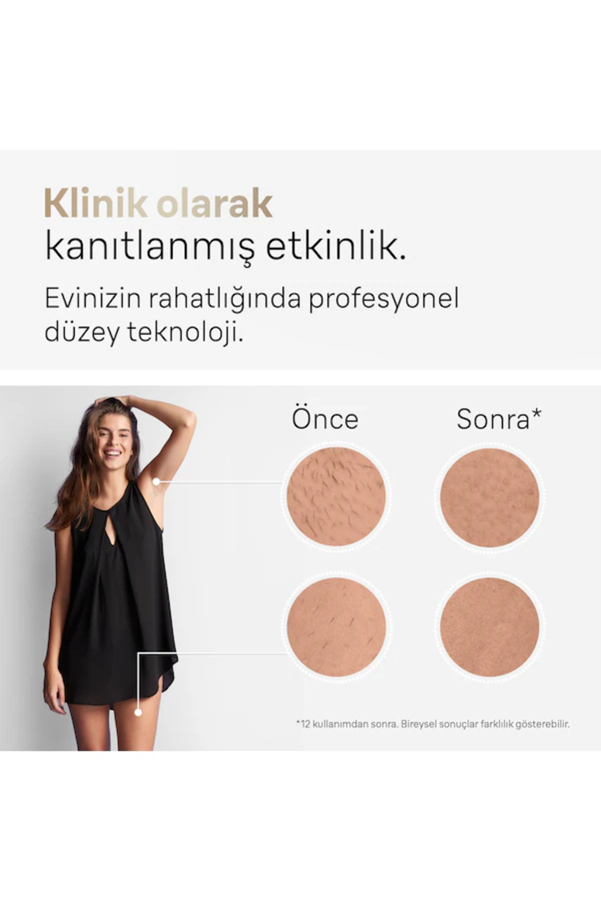  دستگاه لیزر رنگ زائد Silk Expert Pro 5 IPL به همراه کیف حمل و 2 سری + شیور Venus — PRA-12074038-9372  — تصویر 6 از 7