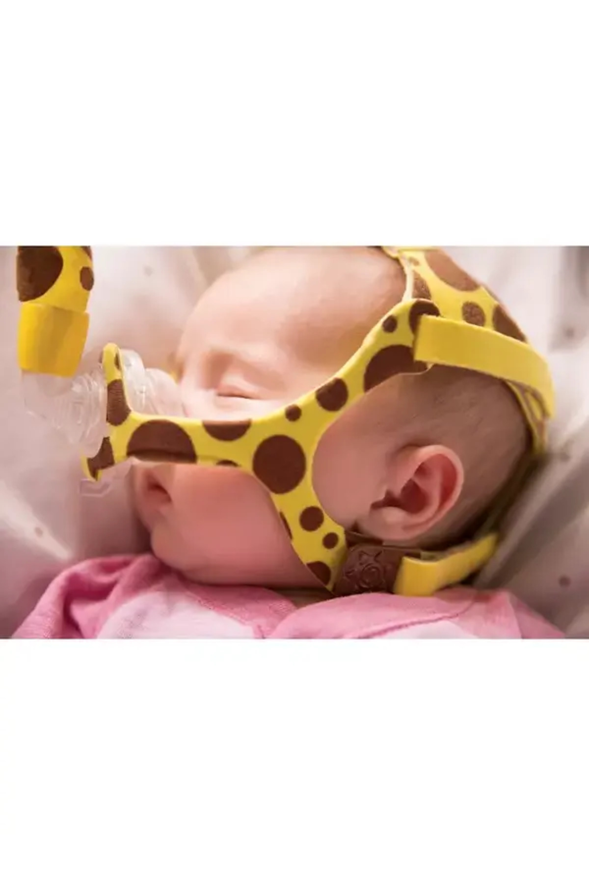 Philips Pediatrik Wisp Maske Zürafa Model fotoğrafı 2 (önizleme)