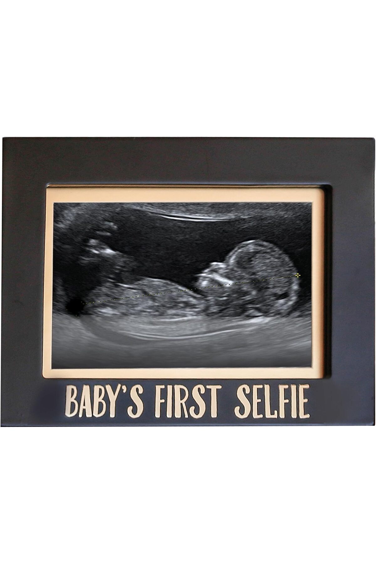 DRKLA DKLAALKD2 Bebeğin İlk Selfie Sonogram Resim Çerçevesi, Cinsiyetsiz Bebek Hatırası Fotoğraf Ç