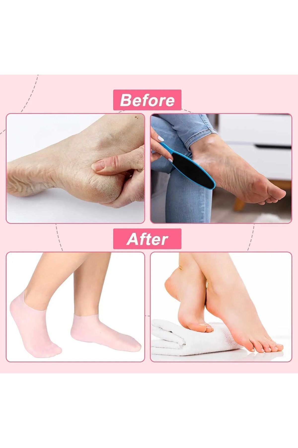 ژل مرطوب‌کننده سیلیکونی اسپای جوراب پاشنه برای مراقبت از پا