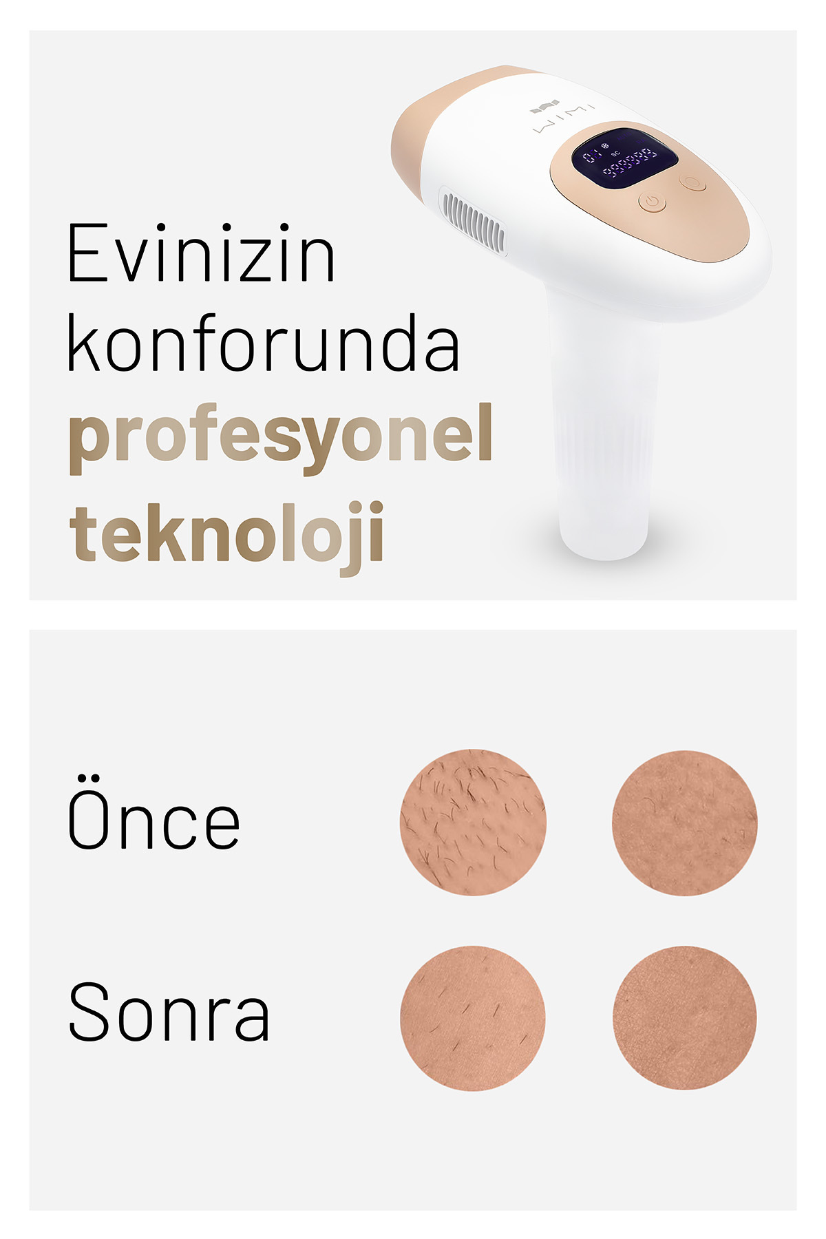 Ipl Buz Lazer Epilasyon Aleti Tüy Alma Cihazı, 12 Kademeli, 999.900 Atım Otomatik Ve Manuel — سفید LZR-1 — تصویر 6 از 8