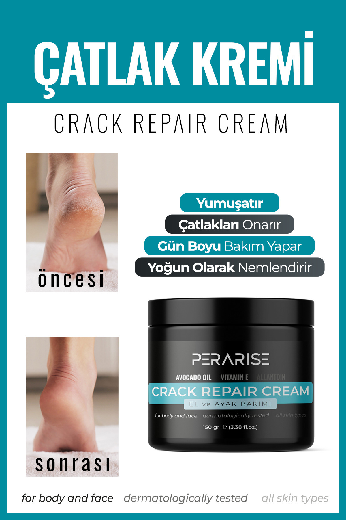PeraRise Yumuşatıcı Ayak Tırnak Beyazlatıcı Etki Topuk Çatlak Koku Giderici Nemlendirici Bakım Kremi 100 ml