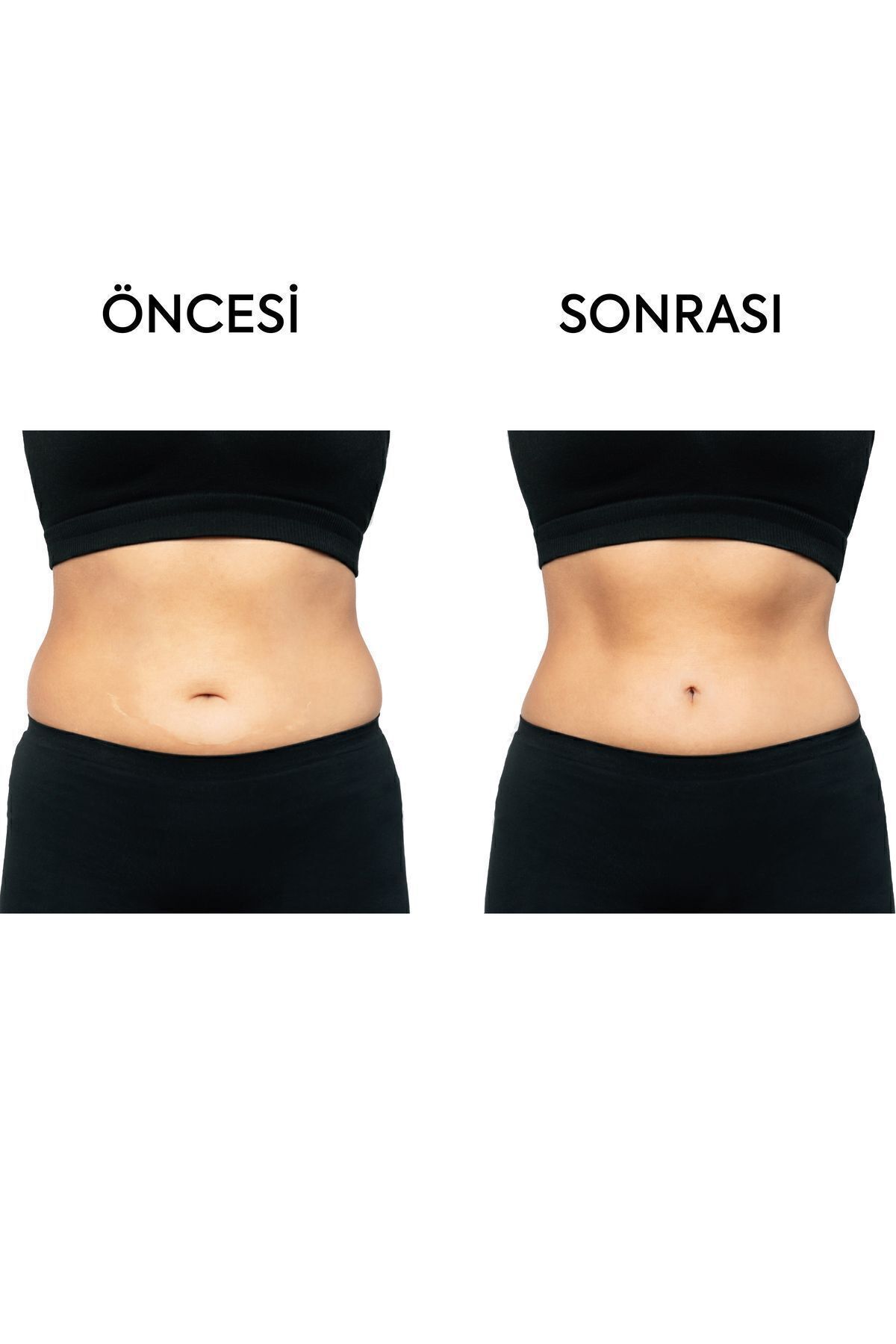 Serrano Biberi Özlü Sıkılaştırıcı Bölgesel İncelme Selülit ve Çatlak Karşıtı Soğuk Lipoliz Jel 250ml — TFOFG01 — تصویر 3 از 6