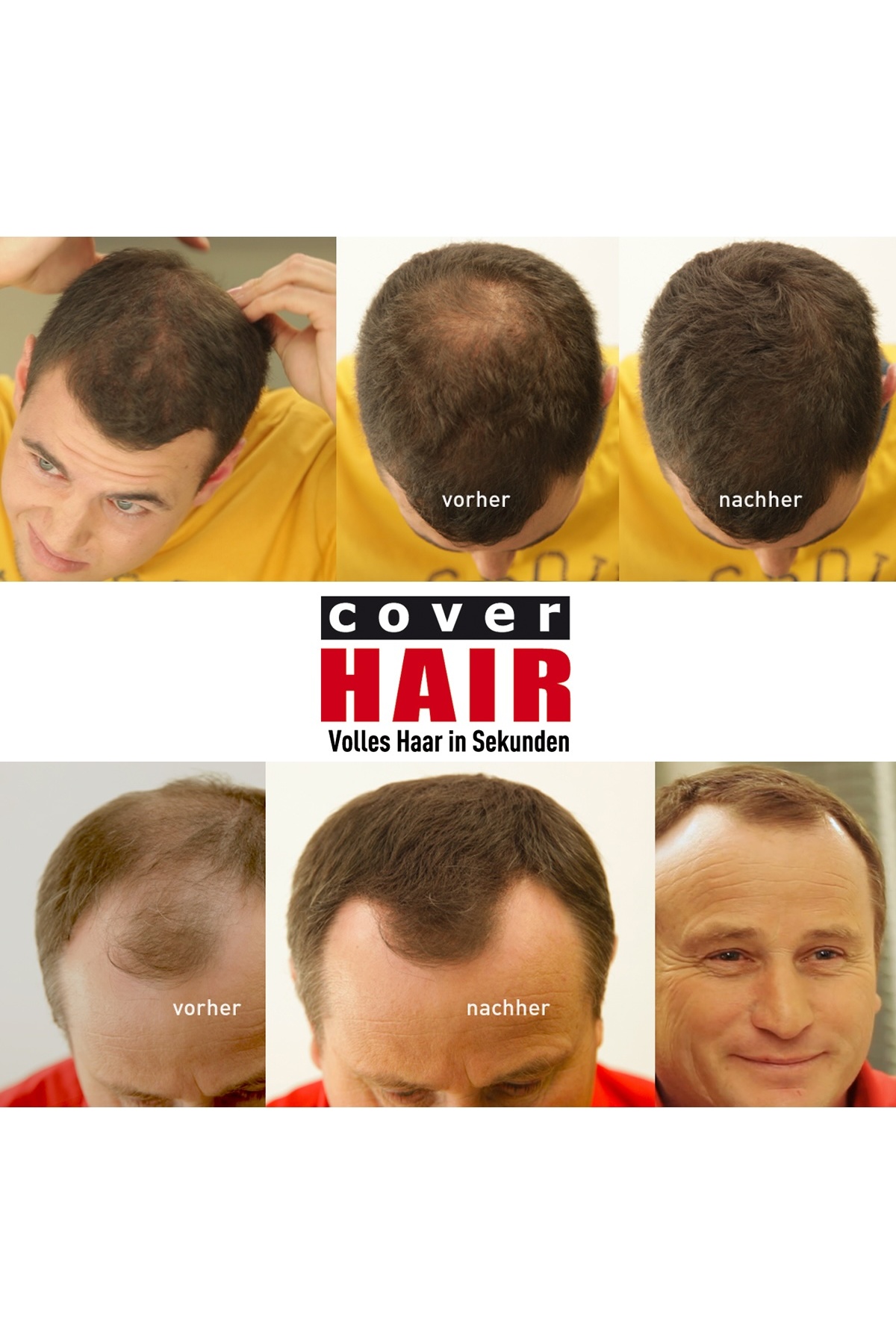 Orta Kahve 14 Gramm Saç Fiberi Dolgunlaştırıcı Kellik Kapatıcı Toz (Topik Tozu) — قهوه‌ای Cover Hair 14 Gramm — تصویر 6 از 8