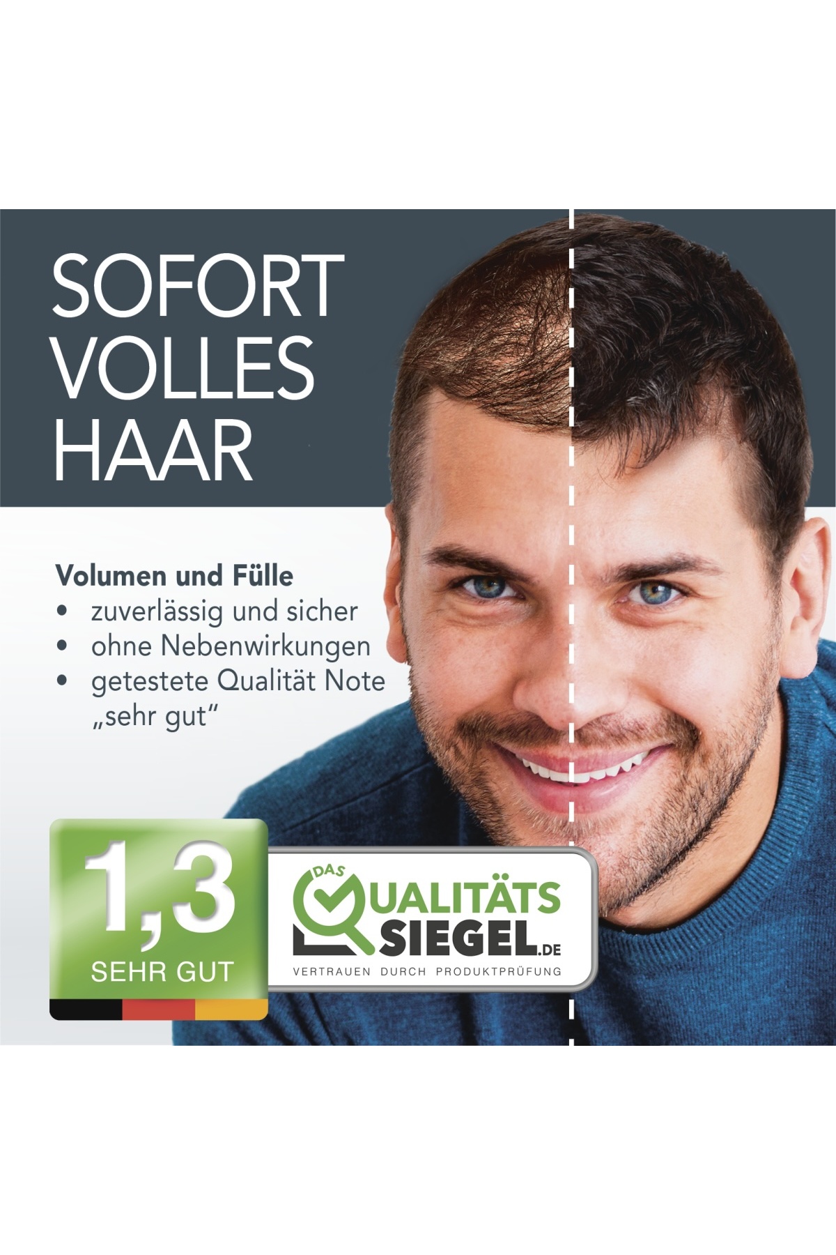 Orta Kahve 14 Gramm Saç Fiberi Dolgunlaştırıcı Kellik Kapatıcı Toz (Topik Tozu) — قهوه‌ای Cover Hair 14 Gramm — تصویر 5 از 8