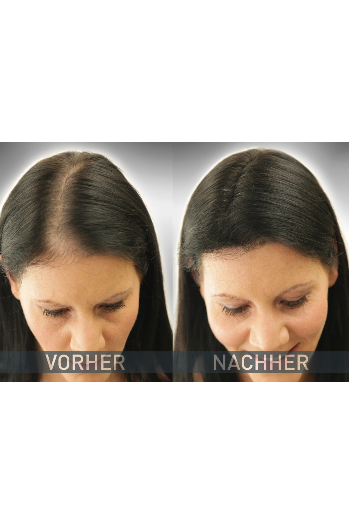 Orta Kahve 14 Gramm Saç Fiberi Dolgunlaştırıcı Kellik Kapatıcı Toz (Topik Tozu) — قهوه‌ای Cover Hair 14 Gramm — تصویر 7 از 8