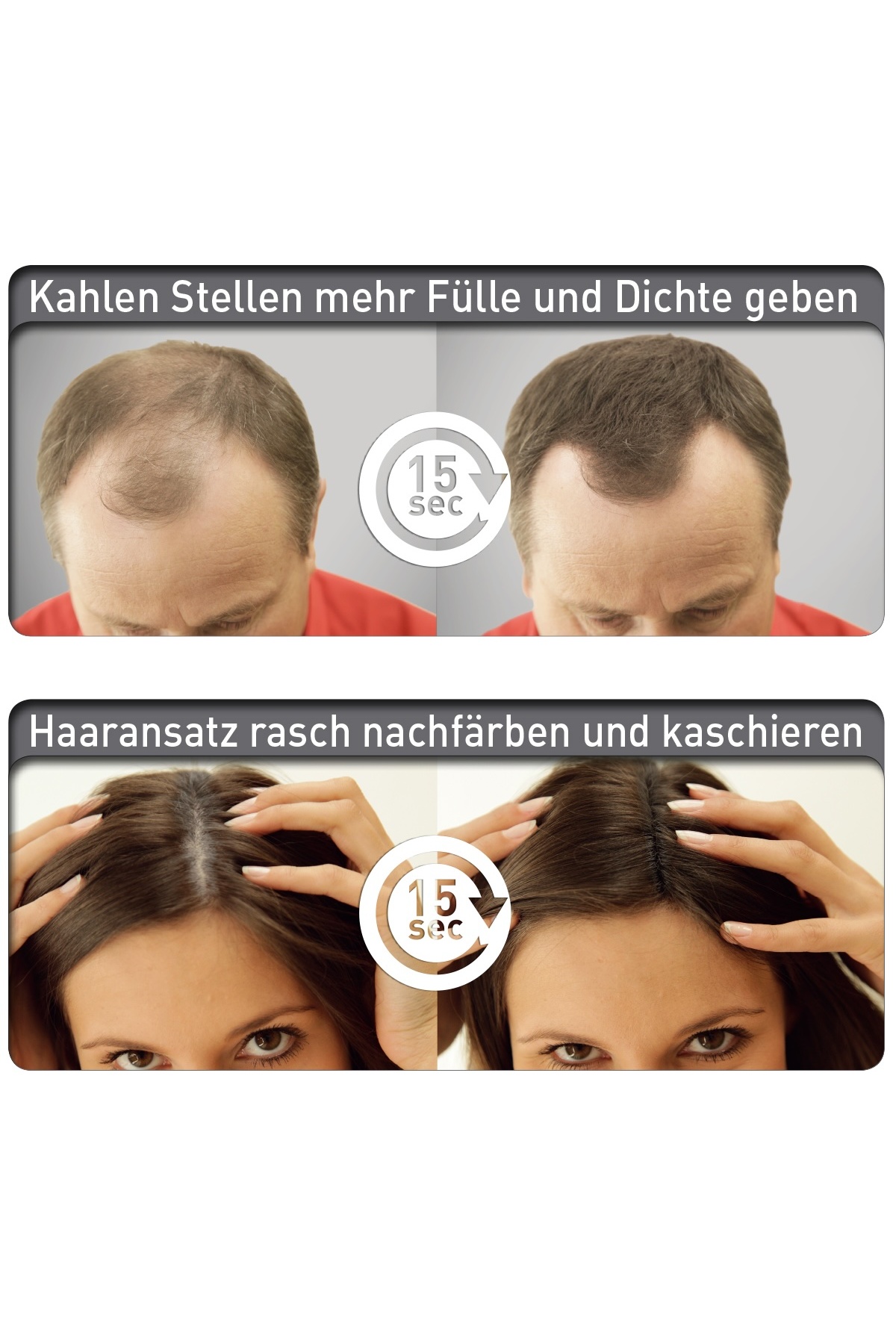 Orta Kahve 14 Gramm Saç Fiberi Dolgunlaştırıcı Kellik Kapatıcı Toz (Topik Tozu) — قهوه‌ای Cover Hair 14 Gramm — تصویر 8 از 8