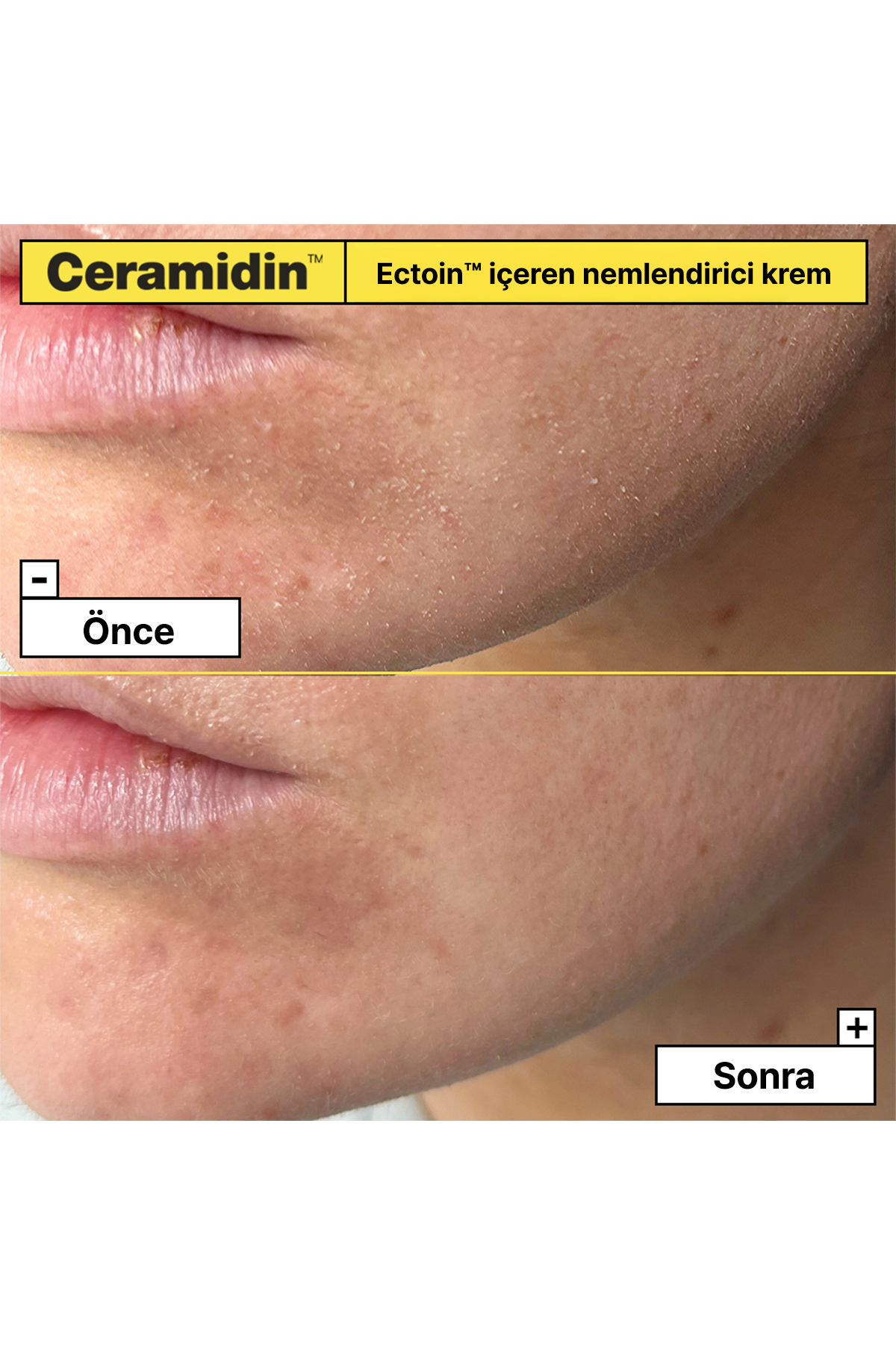 Ceramidin - Ektoin İçerikli Nemlendirici Krem 50ML/1.7FLOZ — H72C01 — تصویر 4 از 8