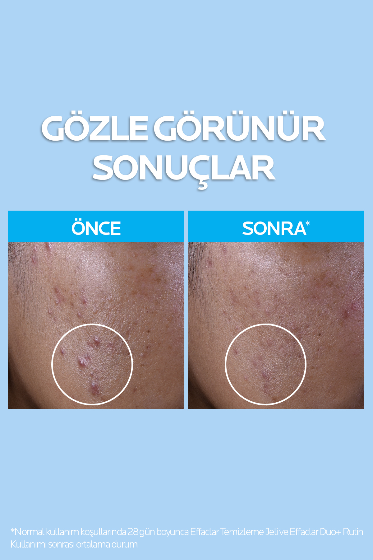 Yağlı Ciltler İçin Cilt Bakım Seti: Effaclar Yüz Temizleme Jeli 400 ml & Sıkılaştırıcı Tonik 200 ml — 8681689317652 — تصویر 3 از 8