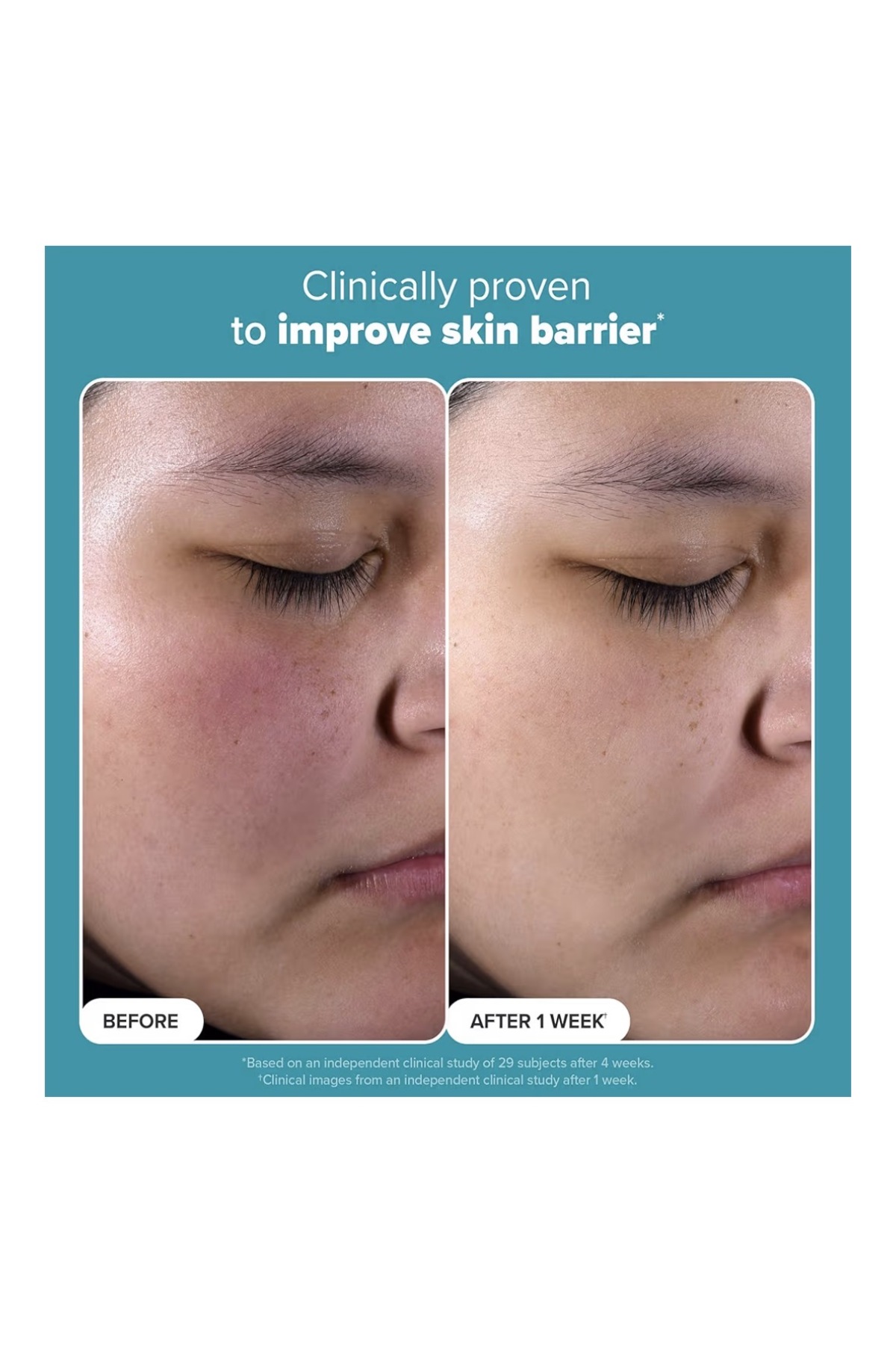 Skin Perfecting 2% BHA Liquid Salicylic Acid Exfoliant, Gentle Facial Exfoliator for Blackheads 1fl Supplements, — gh6tgf — تصویر 6 از 7