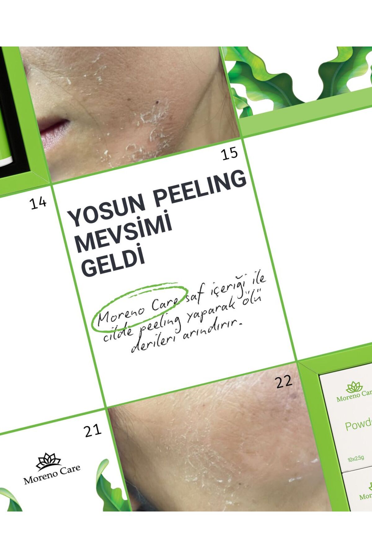 Yosun Peeling Allgae 20 Kullanımlık — morenoyosun — تصویر 3 از 3