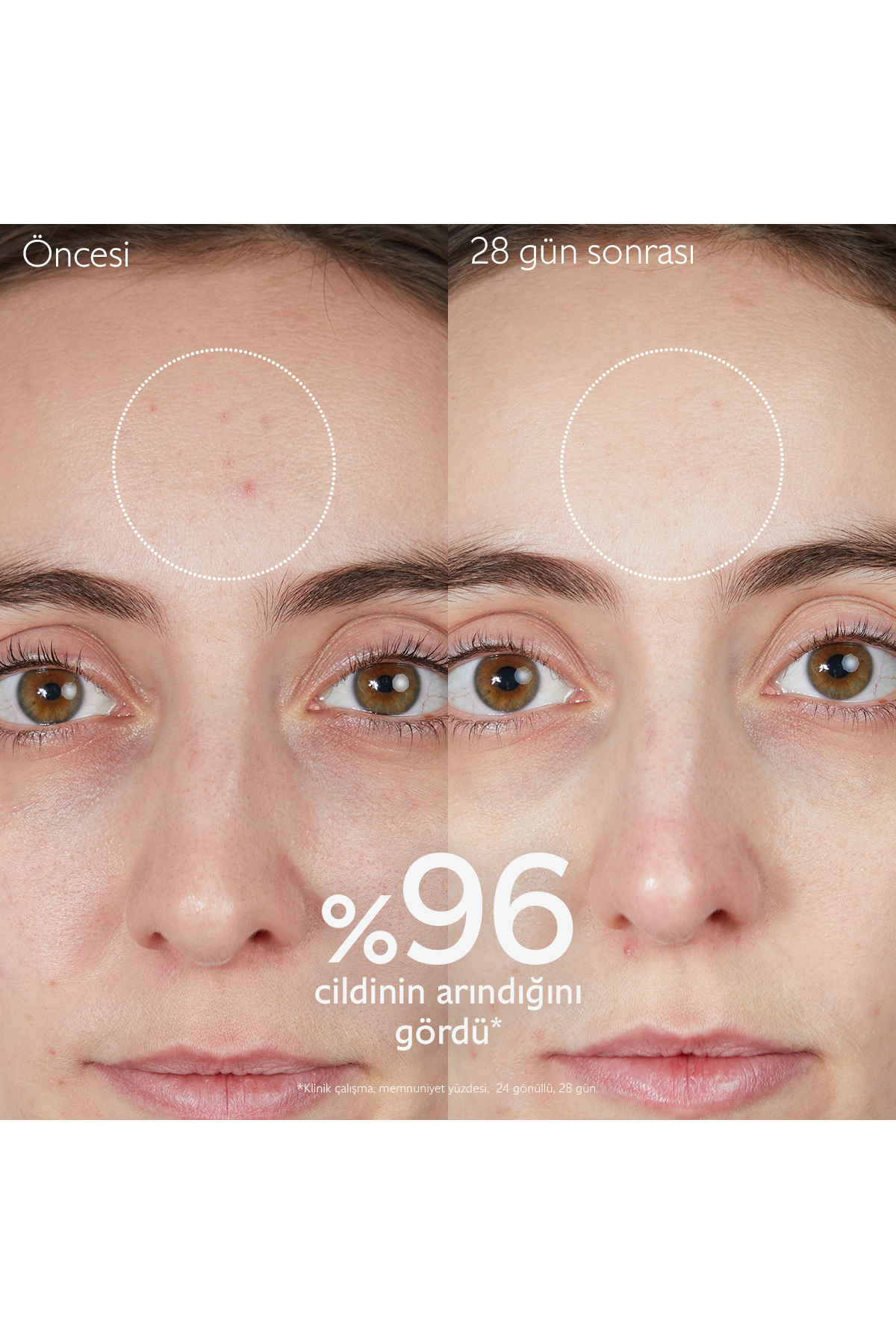 Vinopure Arındırıcı Temizleme Jeli150 ml — 505R1 — تصویر 5 از 7