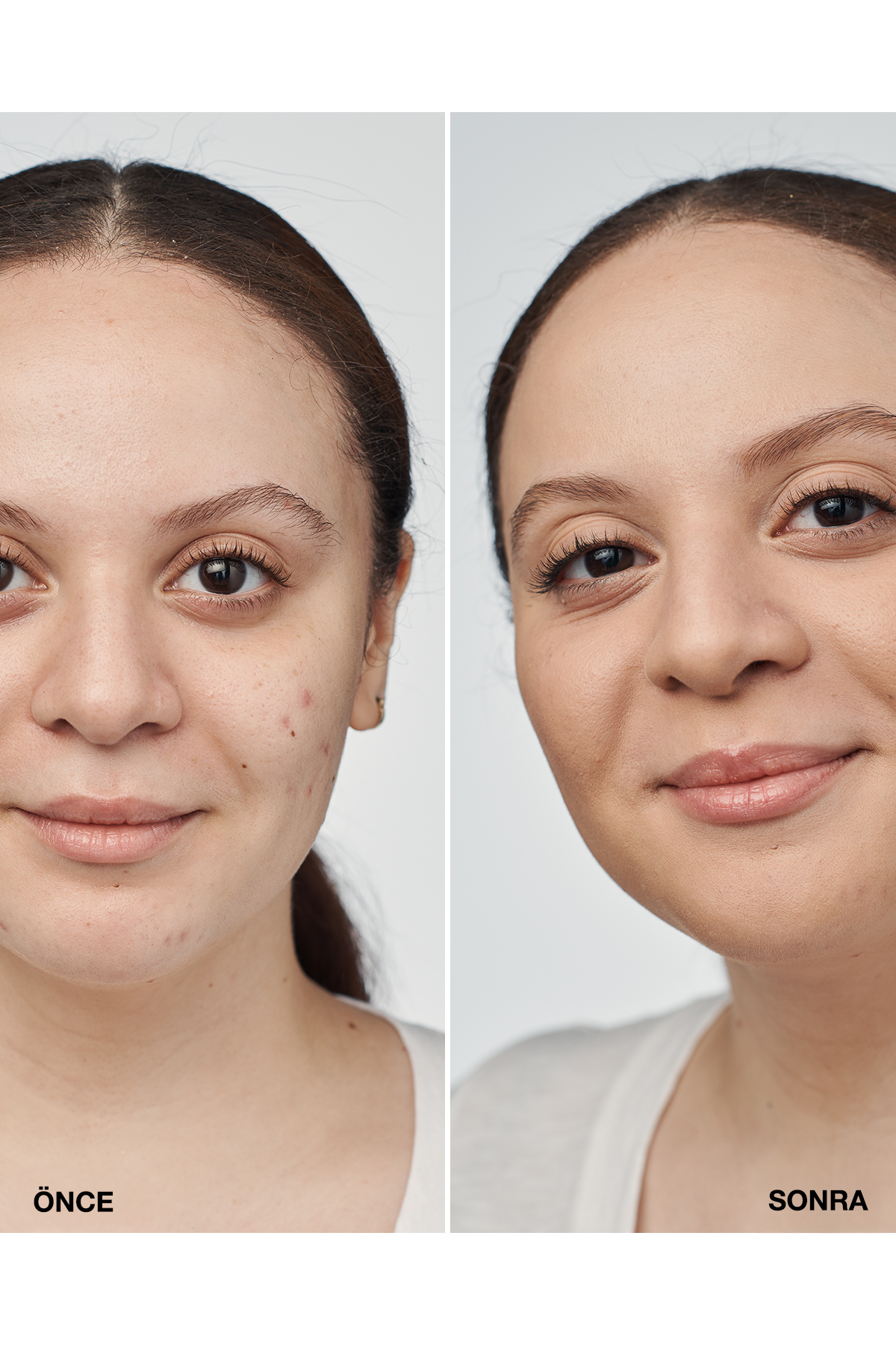 سرم فونداسیون Even Better Clinical™ با SPF 20 - رنگ: Cn 52 Neutral (MF) - 30ml