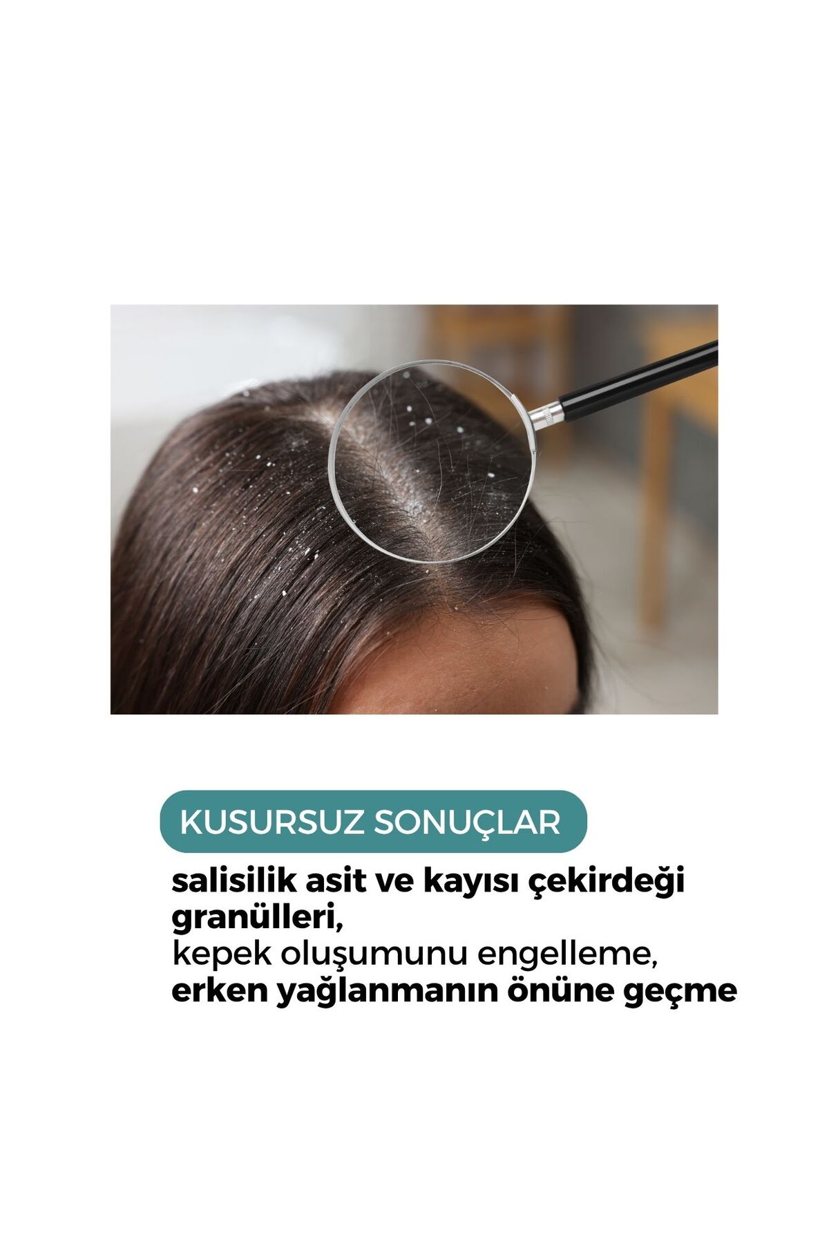 Sebum Oıl Dandruff Haır Peelıng 150 ml — 8680671069494 — تصویر 2 از 3