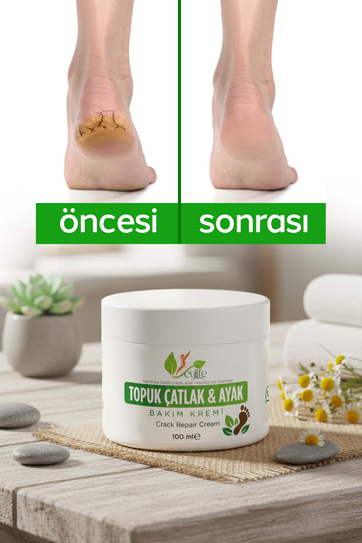 eylife naturel Ayak ve Topuk Çatlak Bakım Kremi 100 ml