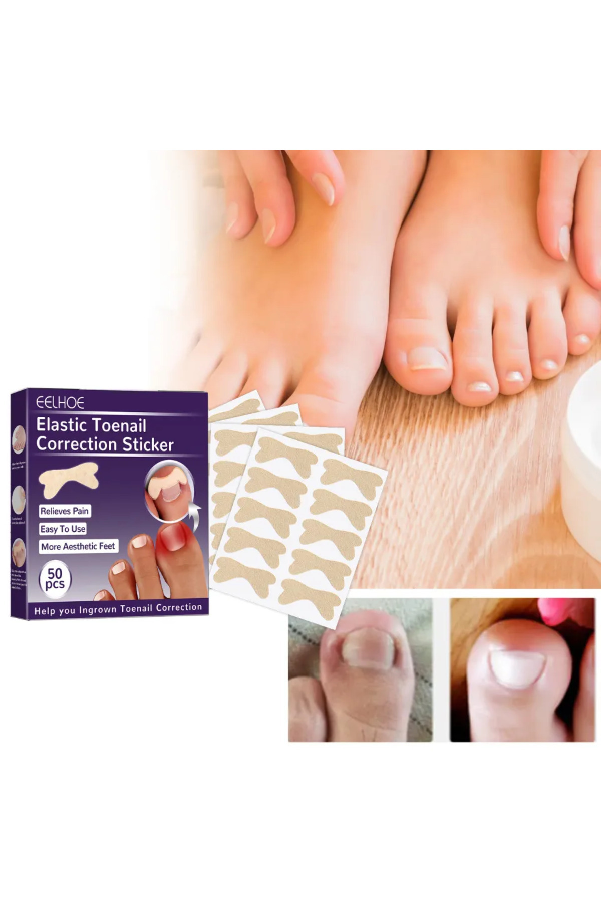 INURA GLOBAL Ayak Tırnağı Düzeltme Bandı 50 Adet