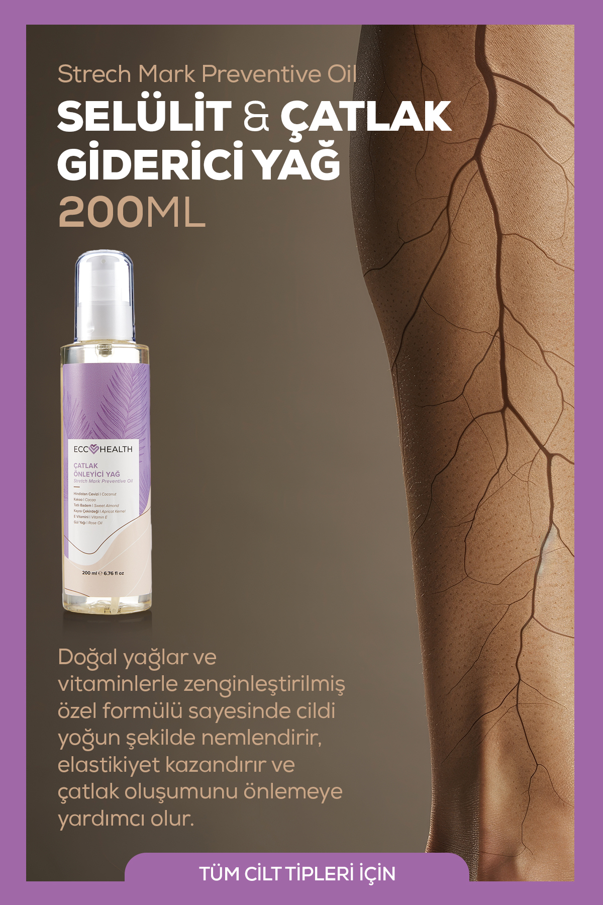 Selülit Çatlak Giderici Yağ | Nemlendirici ve Sıkılaştırıcı Vücut Bakım | Hamilelik ve Sonrası 200 ml — ECC1012A — تصویر 6 از 7