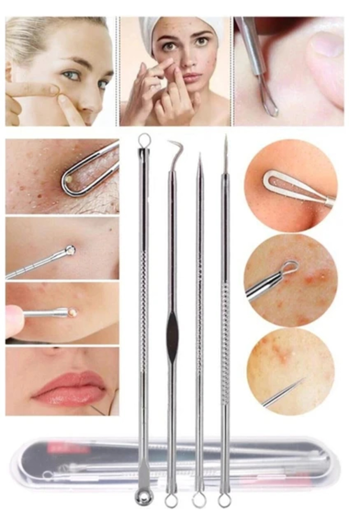 Royal Paris Beauty Makeup Tools Komedon 4'Lü — GUSK-0145 — تصویر 3 از 5