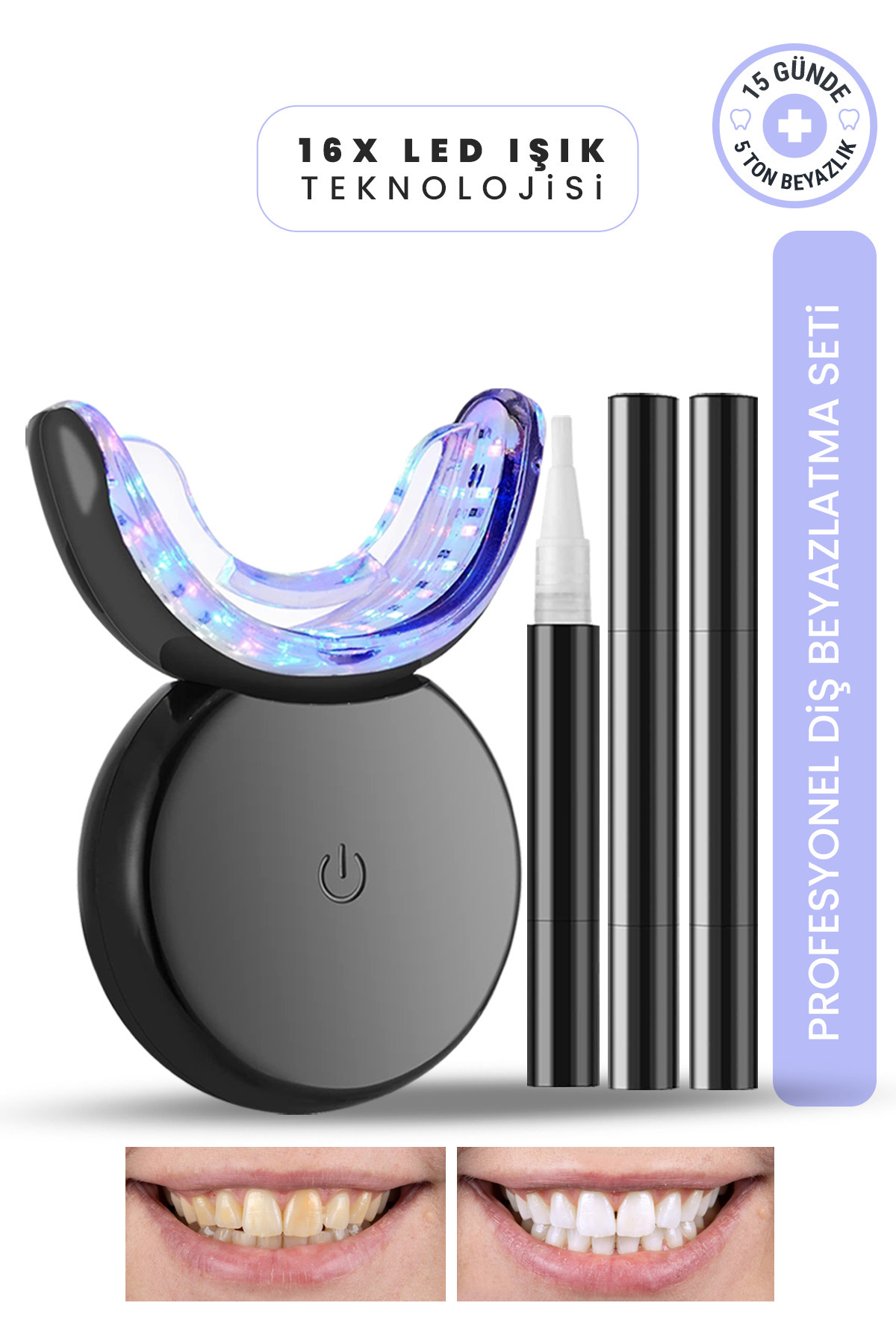 MOEN Profesyonel Diş Beyazlatma Seti 16 Led