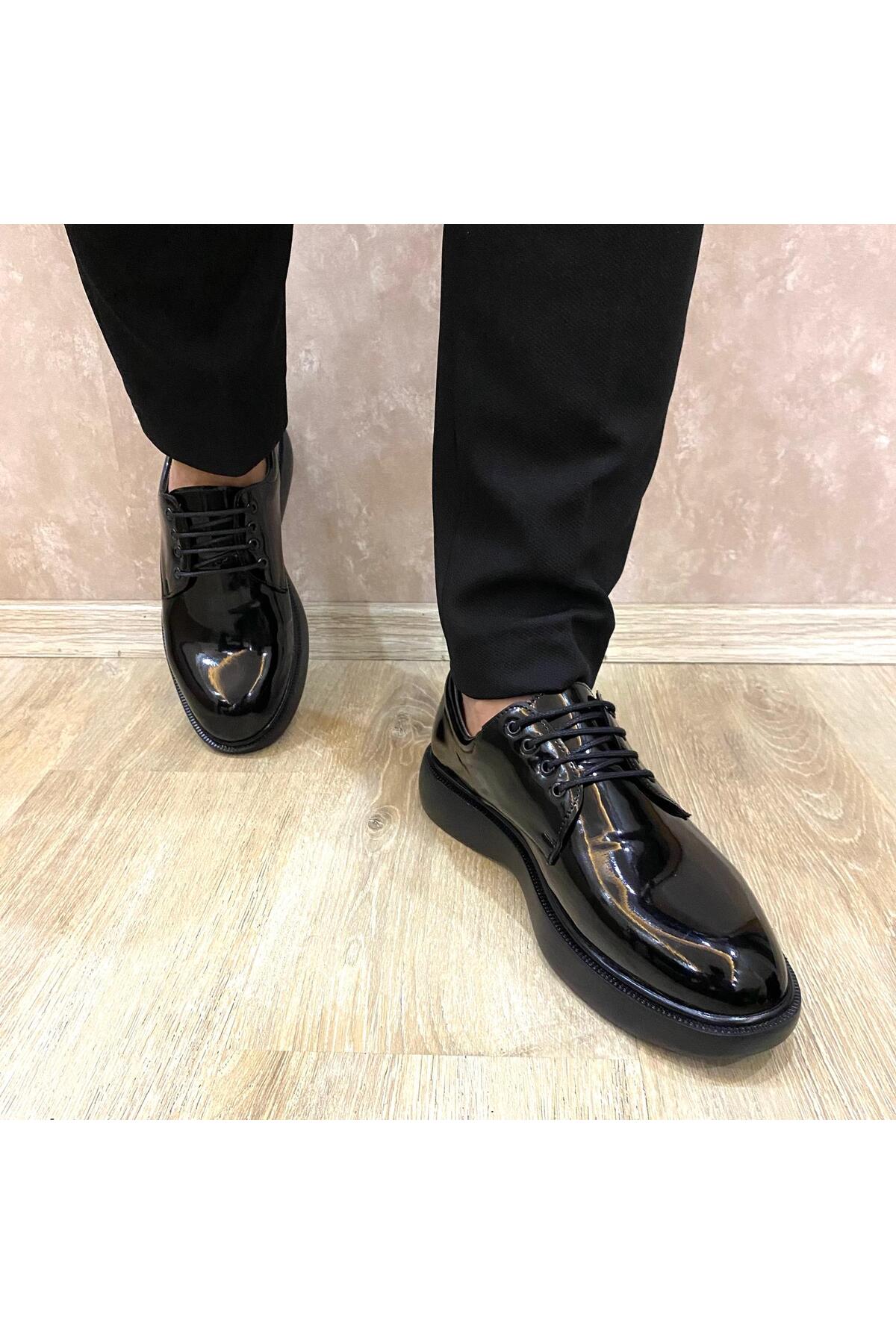 Victoris  Siyah Parlak Kalın Taban Erkek Klasik Ayakkabı – Bağcıklı, Ortopedik ve Günlük Kullanıma Uygun - Görsel 3