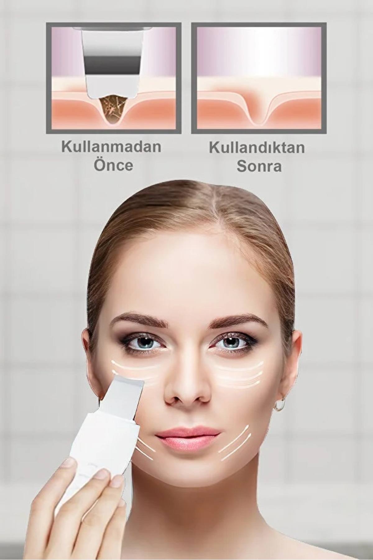 Ultrasonik Spatula Yüz Siyah Nokta Temizleme Cihazı — MBUSPYAGSNTC — تصویر 2 از 6