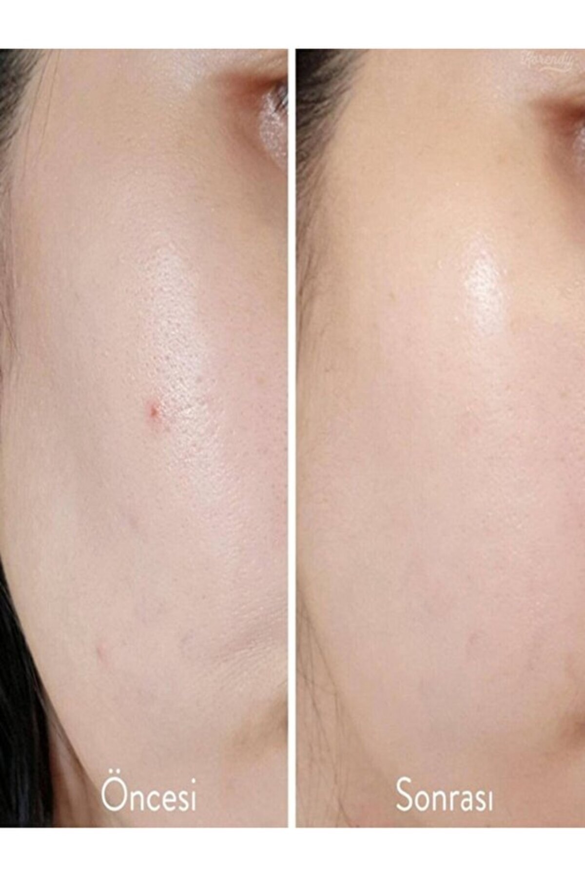 [سایز کوچک] اسکراب لایه بردار معطر بادام با ۵٪ ماندلیک اسید و pH 4.5 (کورندی) ۳۰ میلی لیتر — KRNDY0045 — تصویر 3 از 4