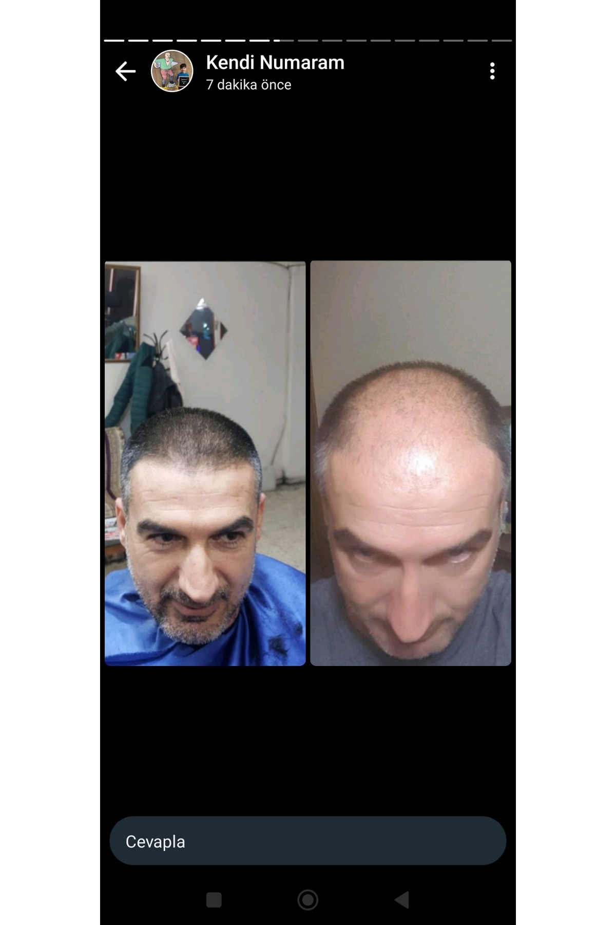 Sarı saç solusyonu — TYCLHSHTXN170383528605201 — تصویر 6 از 8