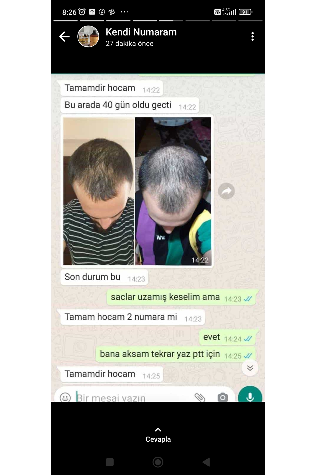 Sarı saç solusyonu — TYCLHSHTXN170383528605201 — تصویر 3 از 8