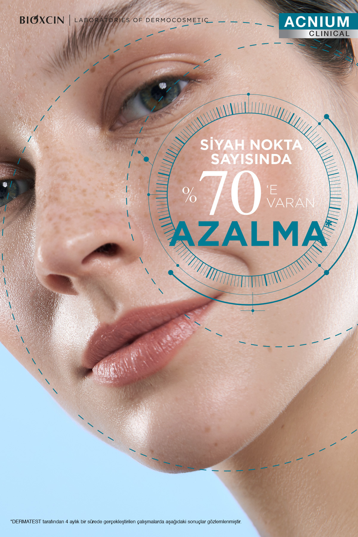 Acnium Tüm Cilt Tipleri İçin Akne Karşıtı Yüz Temizleme Jeli x2 + Tonik + Krem + Serum Seti — BxnAcnmSet — تصویر 4 از 5