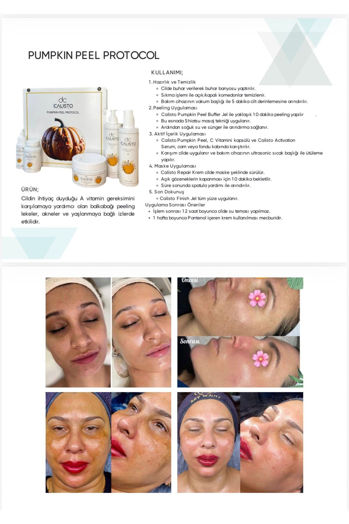 kabak peeling — esoes2 — تصویر 4 از 4