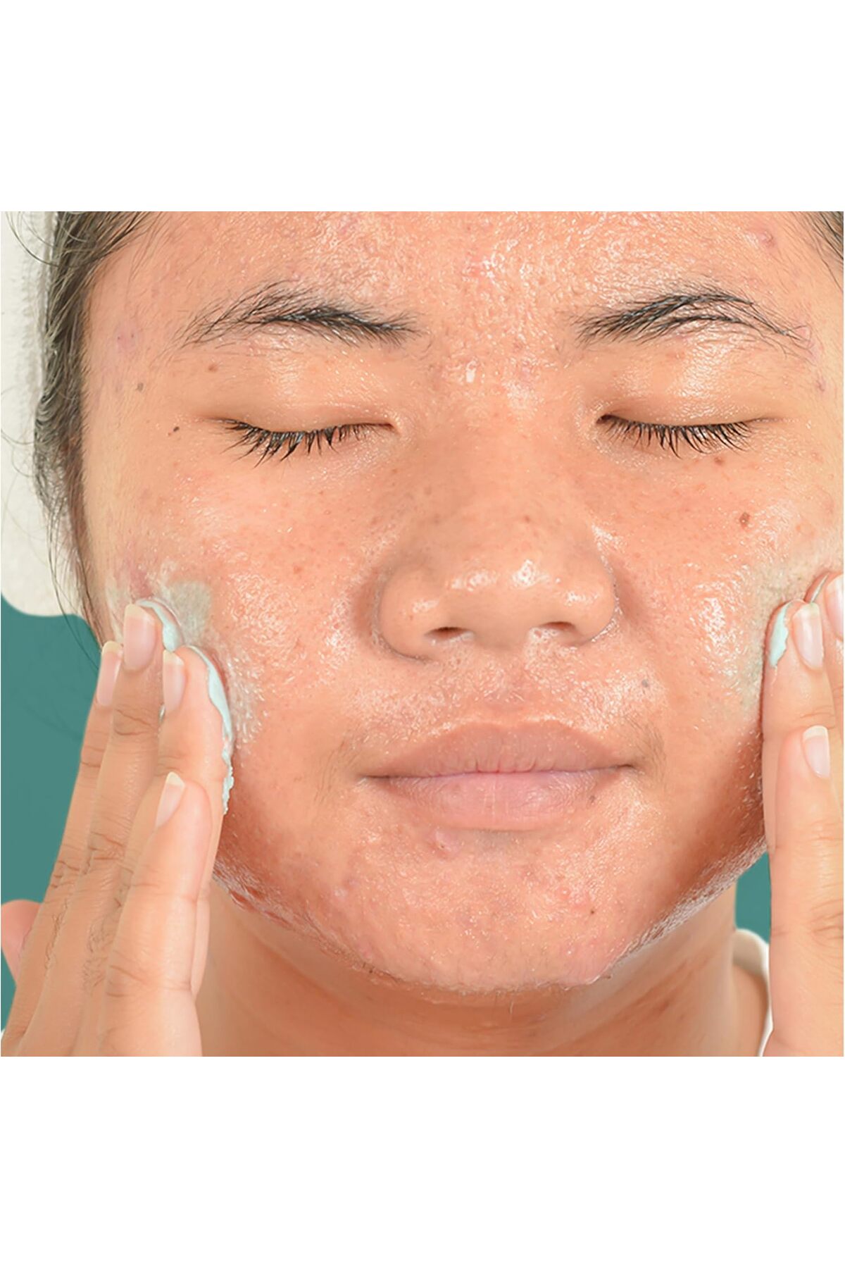 Yağsız Akne Stres Kontrol Güçlü Günlük Temizleme Peeling 125 ML — ntrgn-006 — تصویر 3 از 7