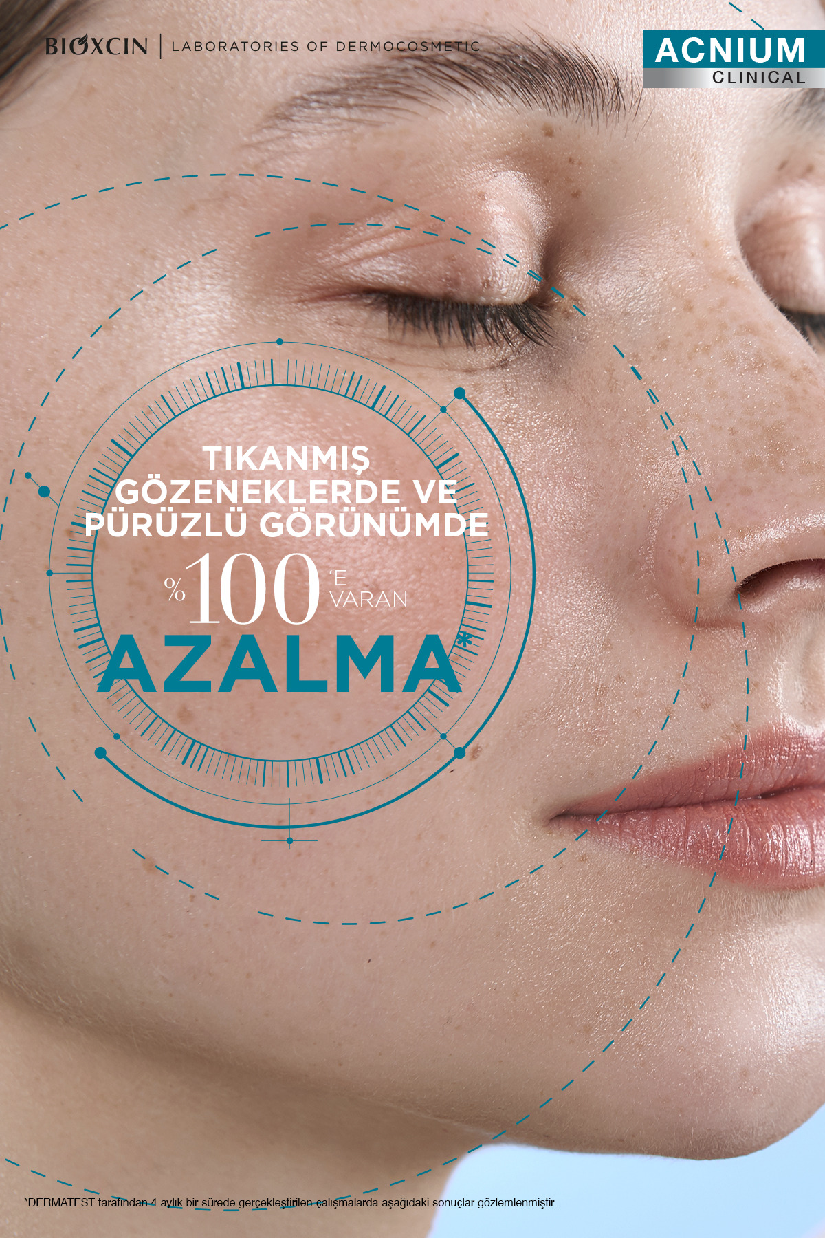 Acnium Tüm Cilt Tipleri İçin Akne Karşıtı Yüz Temizleme Jeli x2 + Tonik + Krem + Serum Seti — BxnAcnmSet — تصویر 3 از 5