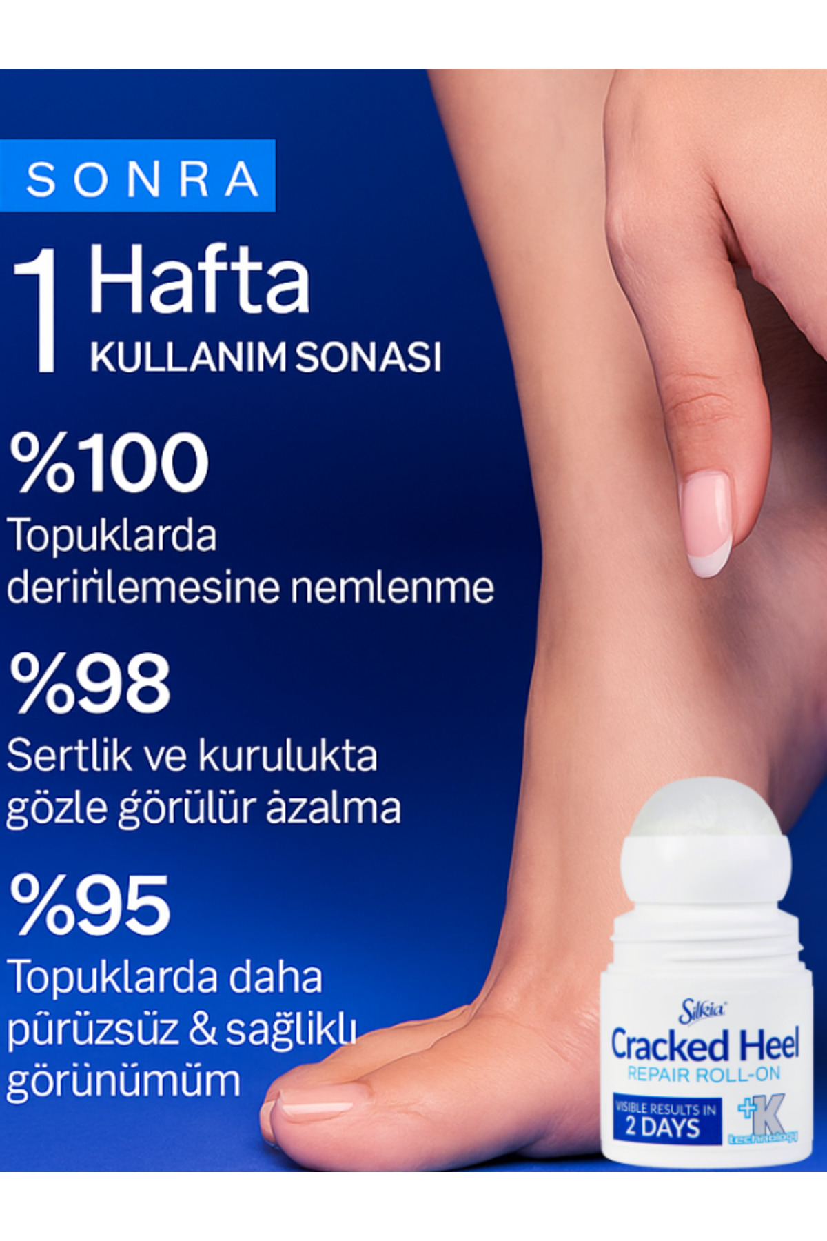 U.K Pedicare Çatlak Topuk Onarıcı Roll-On – 48 Saat Etkili Yoğun Bakım 50 ml — 5017371154725 — تصویر 5 از 9
