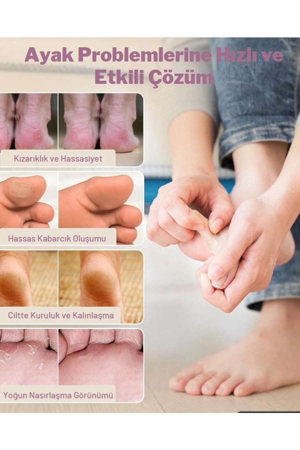 U.K Pedicare Çatlak Topuk Onarıcı Roll-On – 48 Saat Etkili Yoğun Bakım 50 ml — 5017371154725 — تصویر 7 از 9