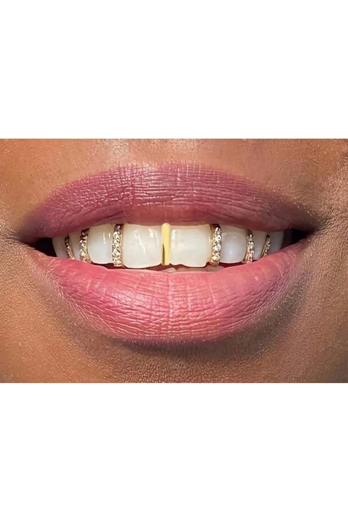 La Saade Y2k Grunge Gold Tekli Taşlı Tooth Gem Diş Grillz Aksesuar